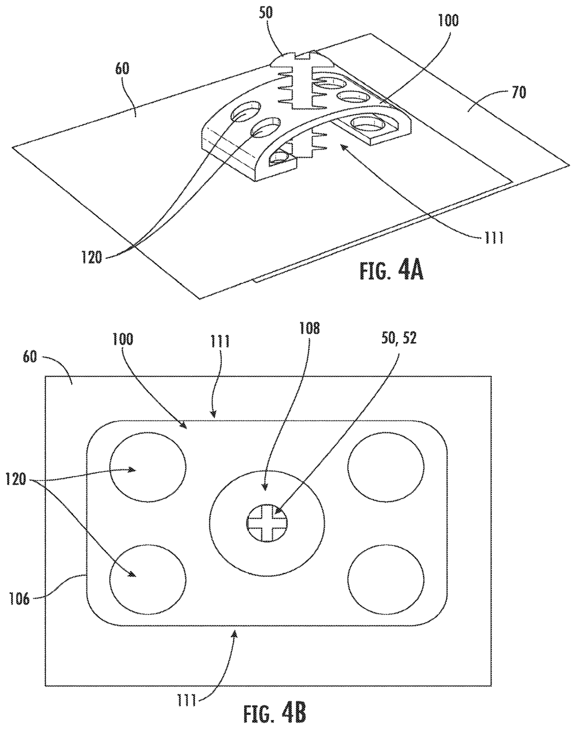 Patent US12359432 Figure 6 – Fastener plate for securing an underlayment to a roof surface