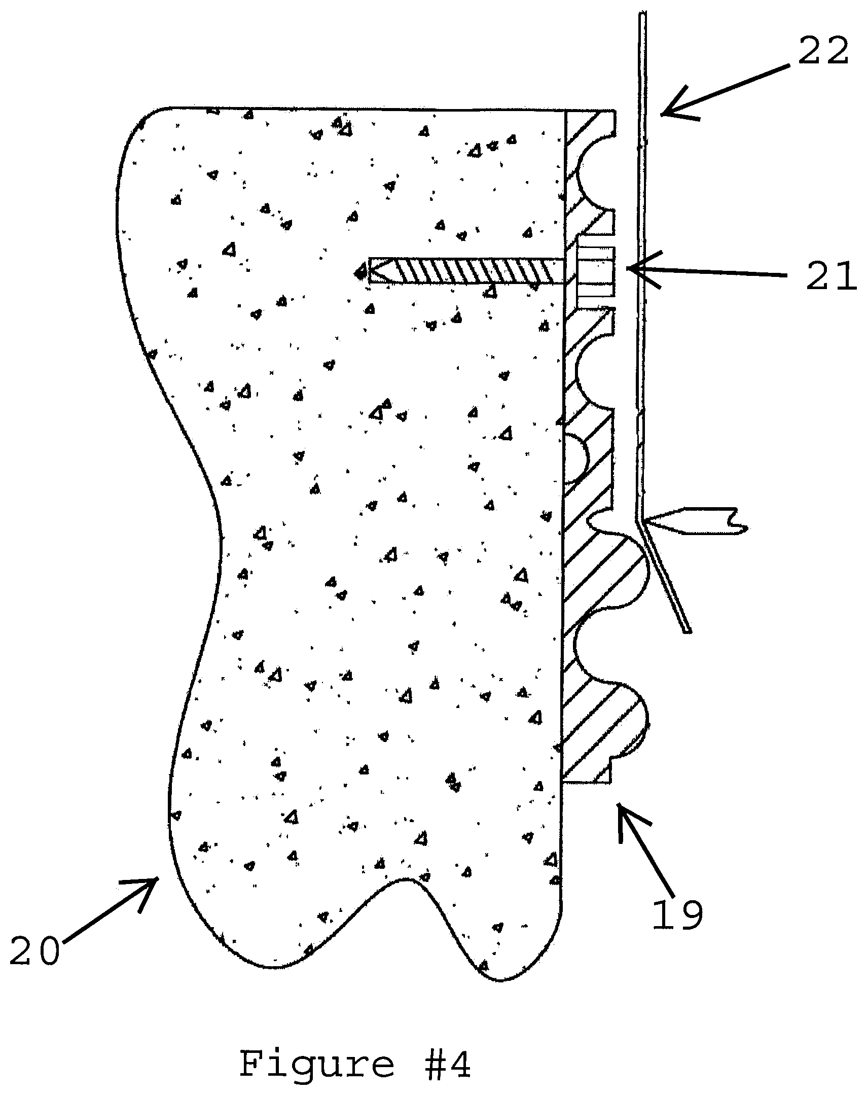 Patent US12359458 Figure 4 – Apparatus for unifying structural continuous load paths and reinforcing a roofing structural system utilizing super high tensile strength tape and plastic attachment mechanisms