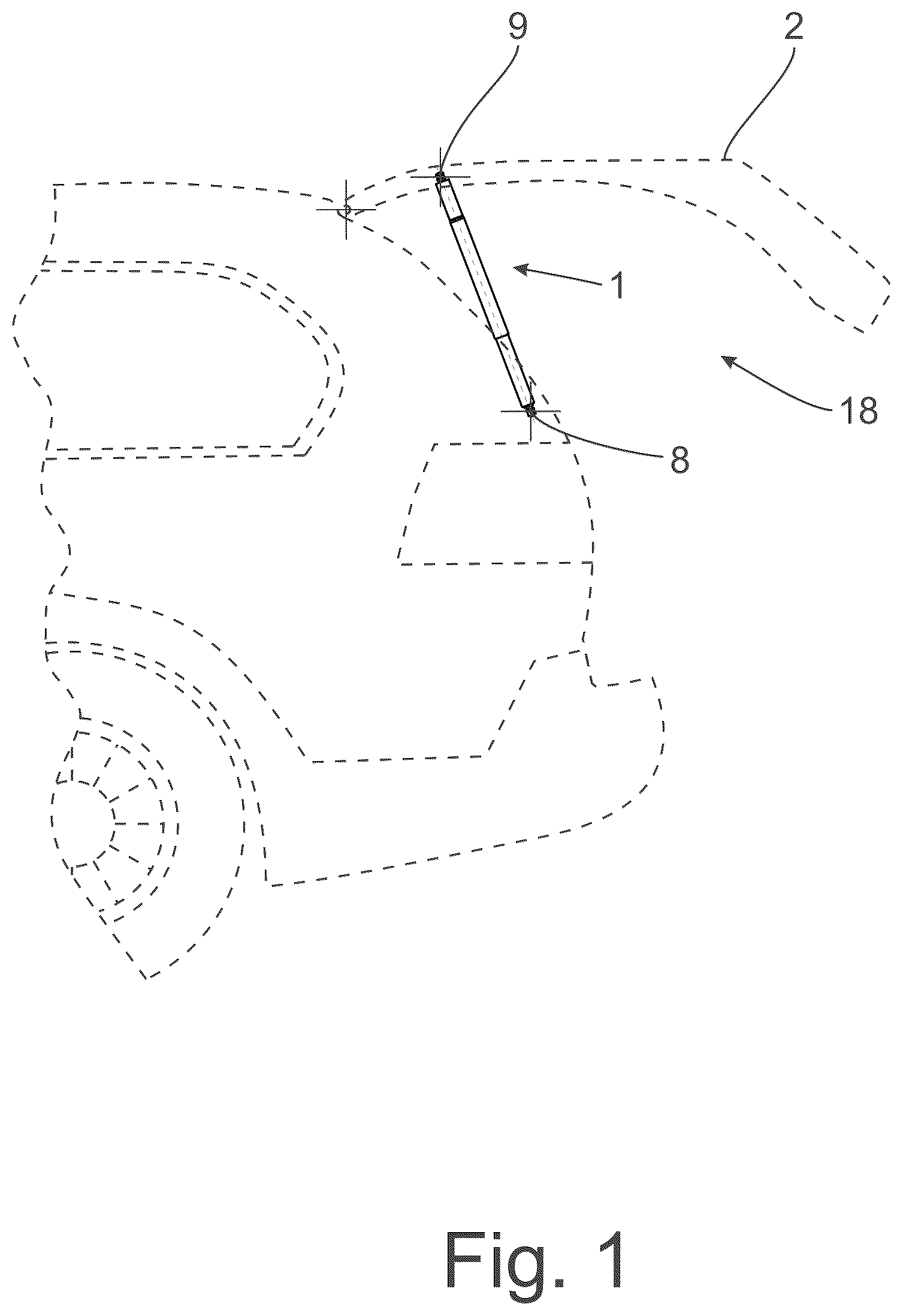 Patent US12359483 Figure 1 – Drive device for a closure element of a motor vehicle