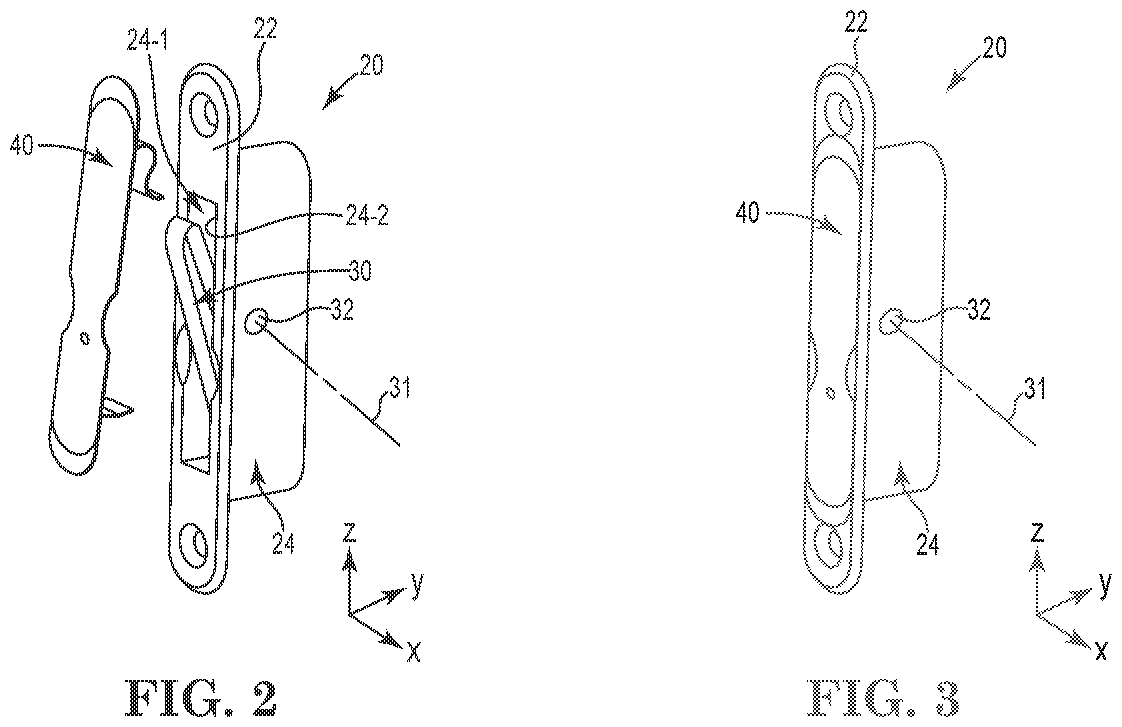 Patent US12359487 Figure 2 – Window opening control device assemblies and methods