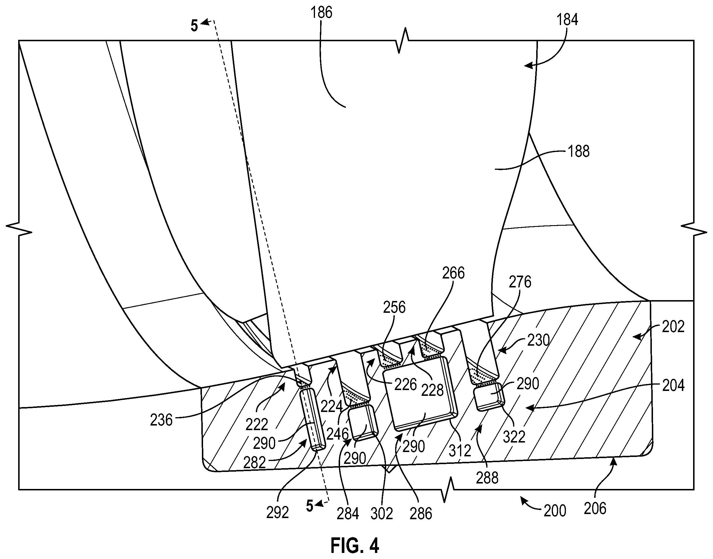 Patent US12359584 Figure 4 – Acoustic engine casing for gas turbine engine