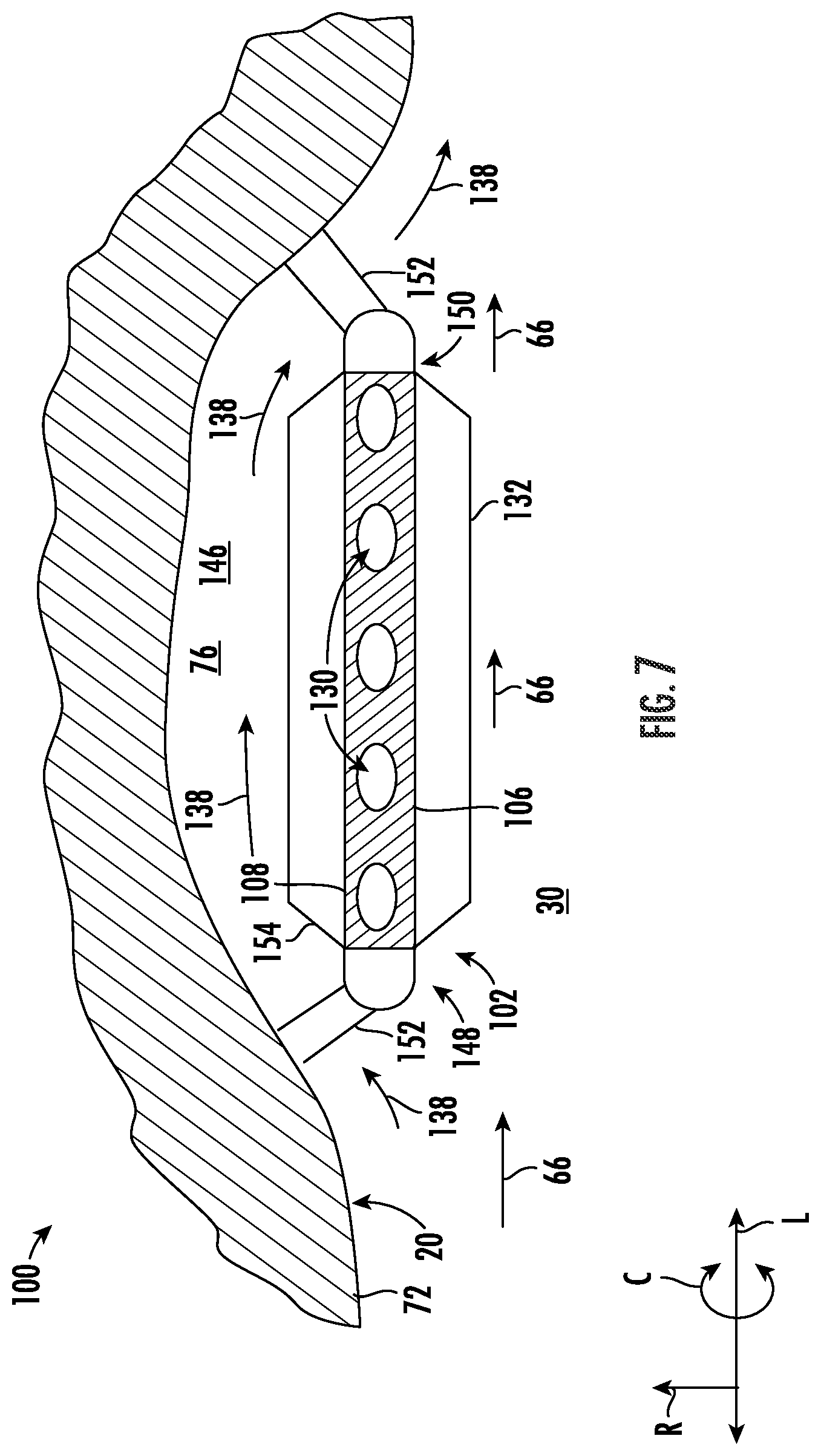 Patent US12359621 Figure 7 – Thermal management system for a gas turbine engine