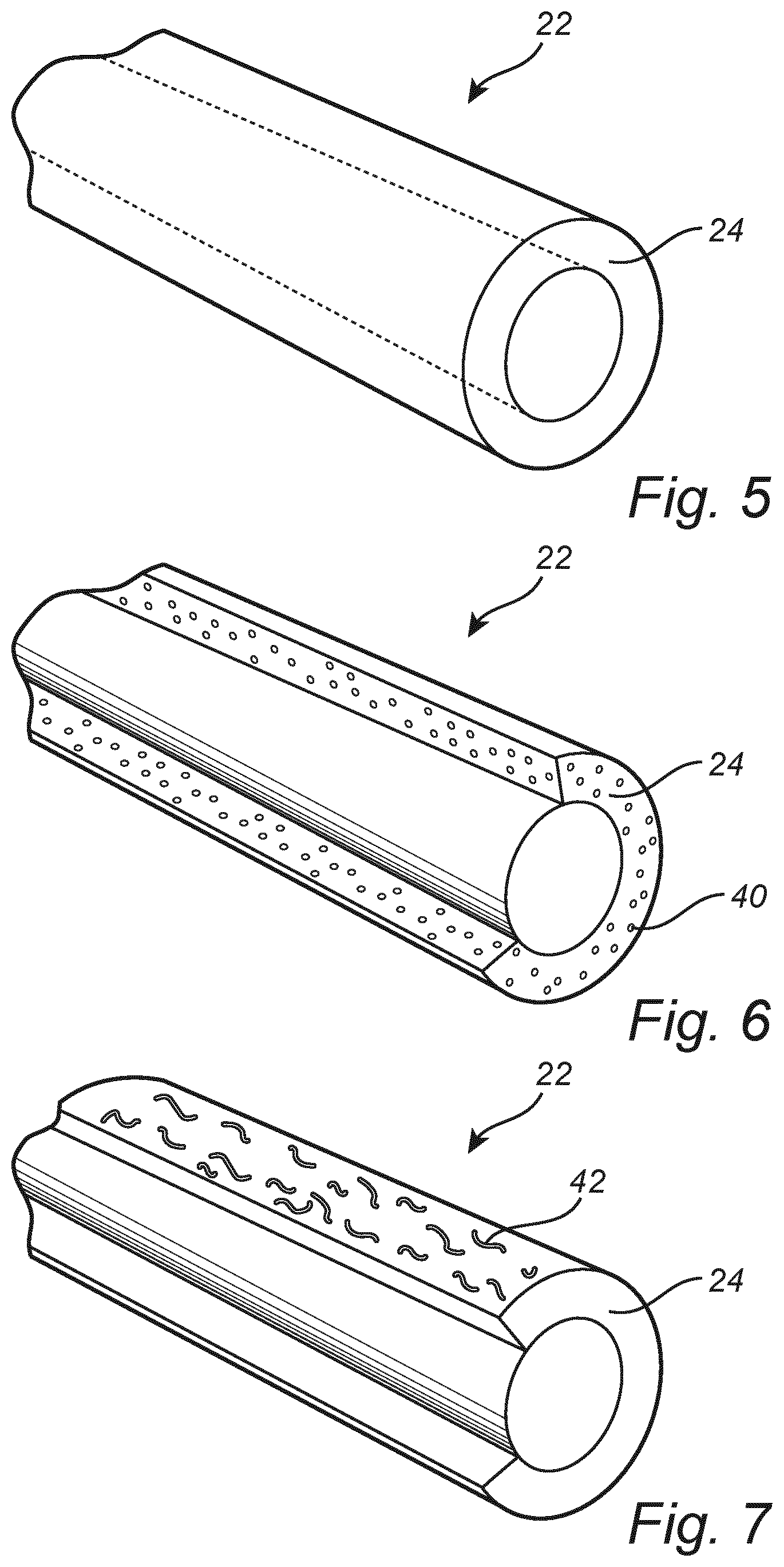 Patent US12359653 Figure 4 – Wind turbine component