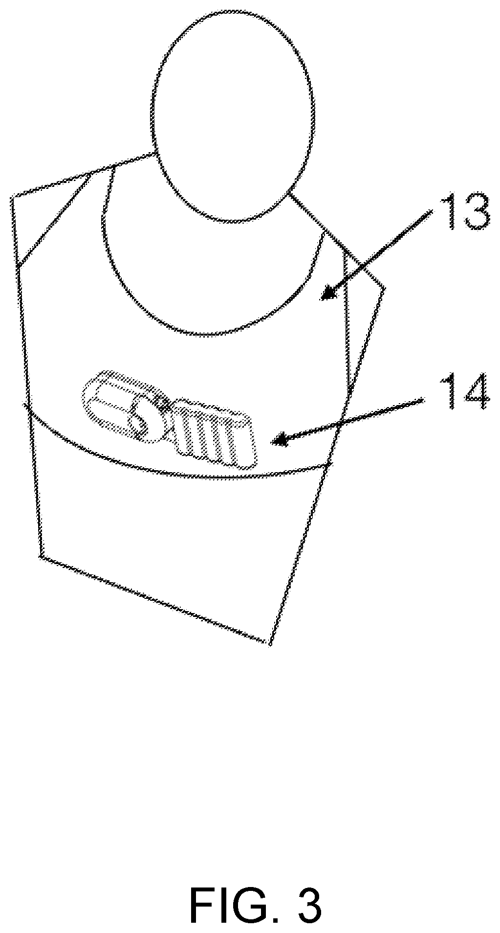 Patent US12359659 Figure 3 – Portable device with disposable reservoir for collection of internal fluid after surgery