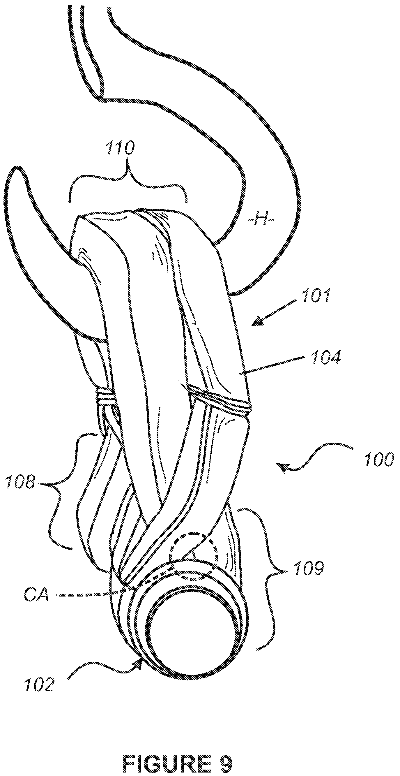 Patent US12359706 Figure 9 – Shackle