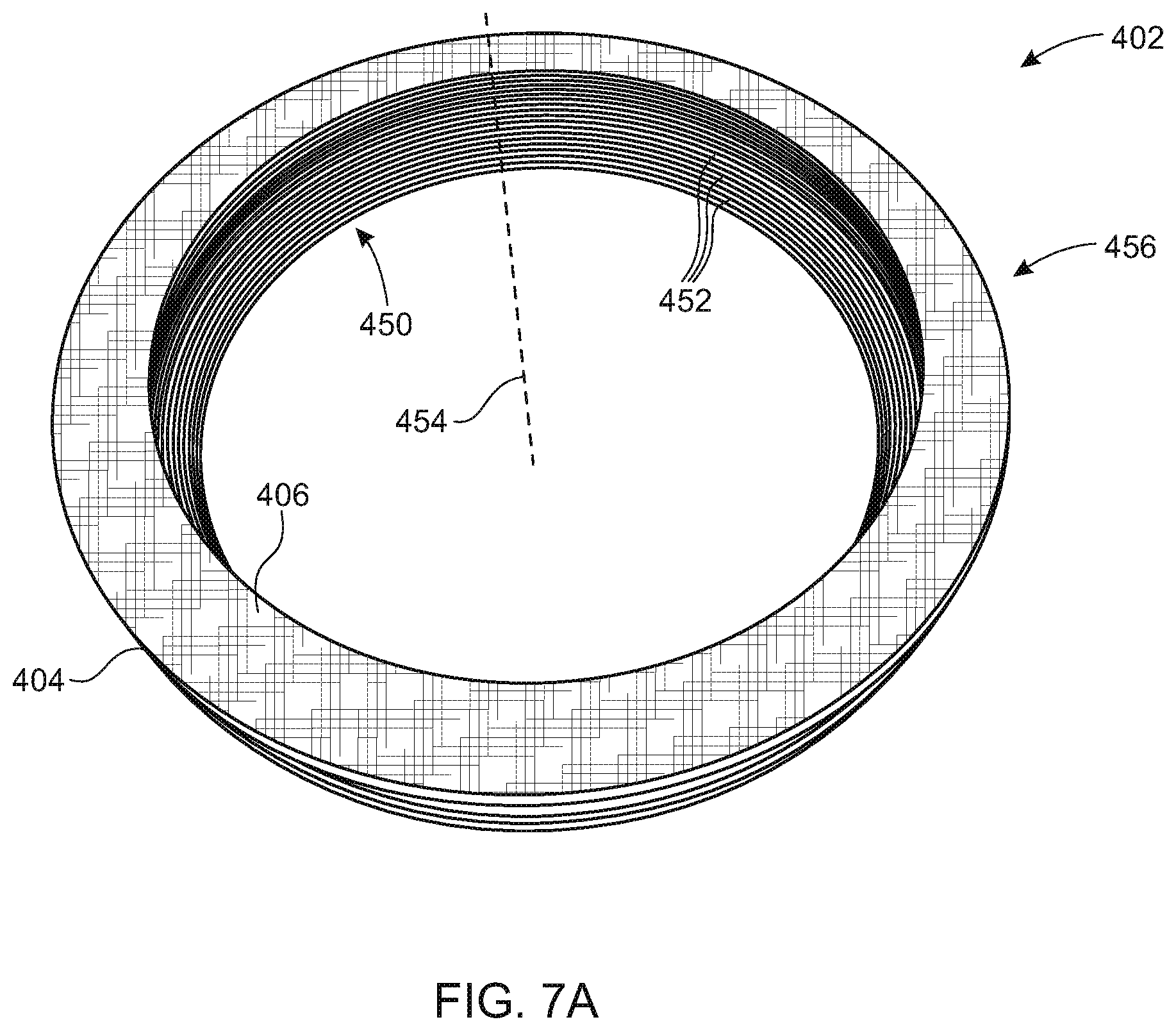 Patent US12359738 Figure 8 – Fiber reinforced valve seal