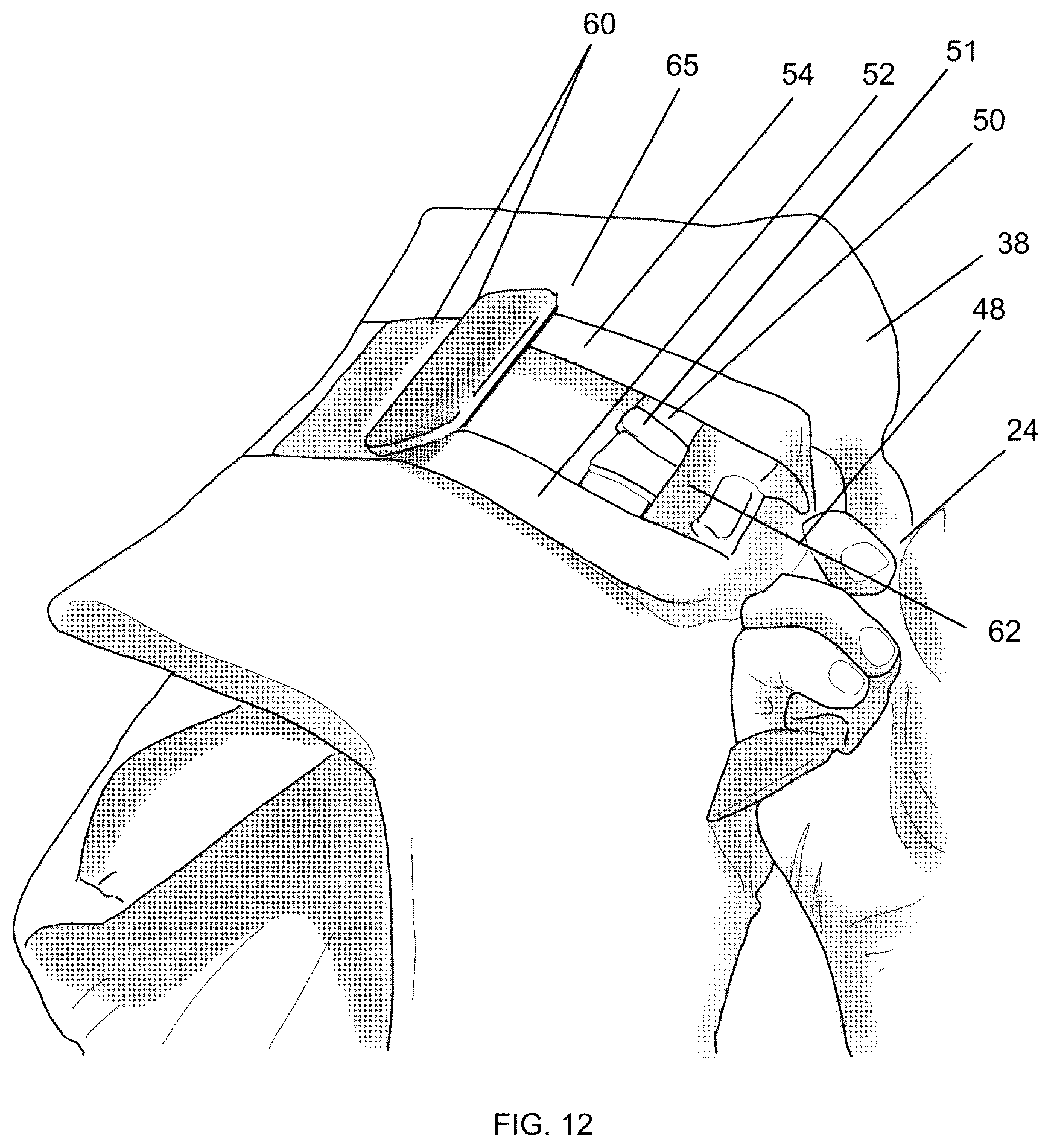 Patent US12359895 Figure 13 – Compact handgun protection ballistic shield