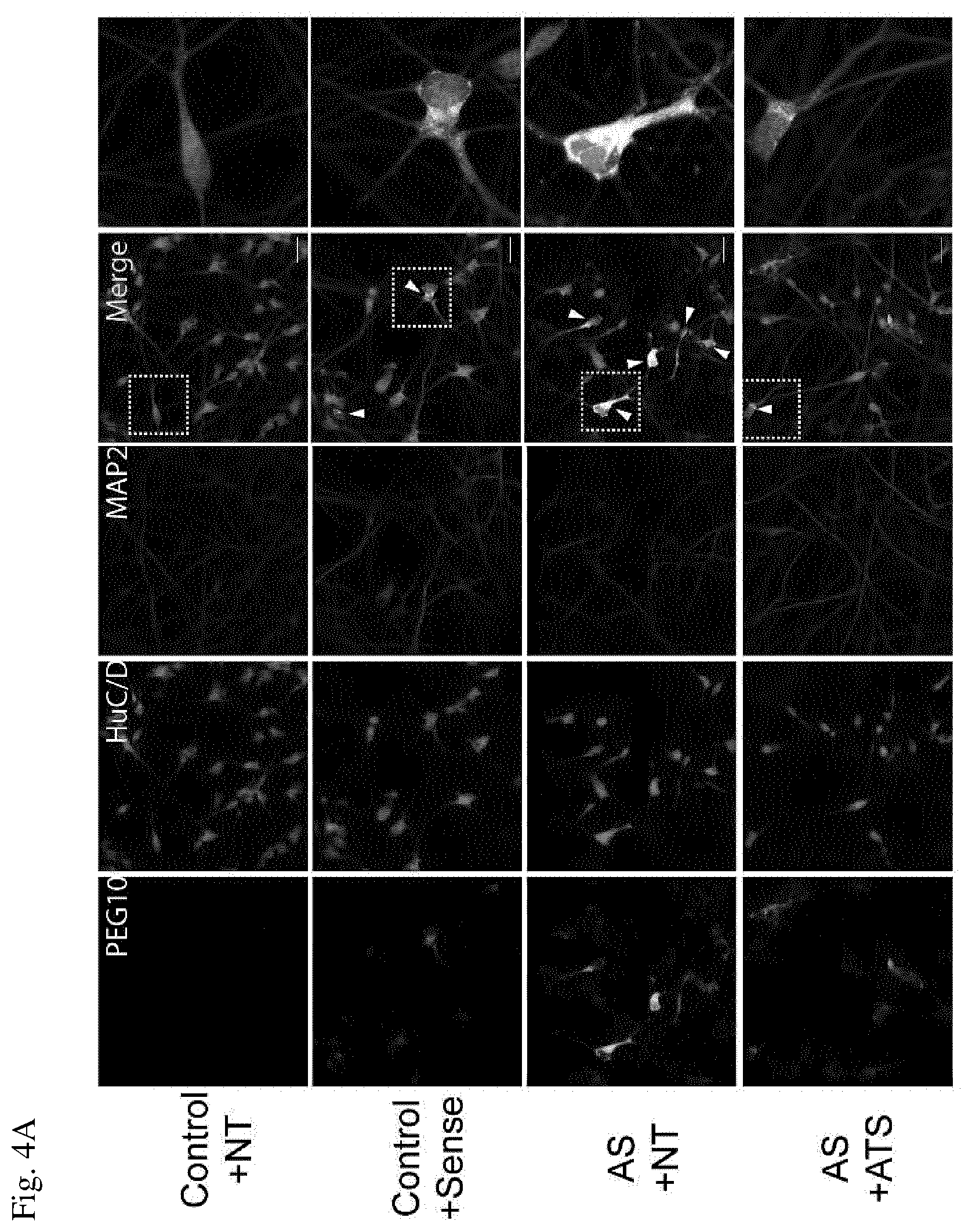 Patent US12360123 Figure 3 – E3 ubiquitin ligase (UBE3A) protein targets