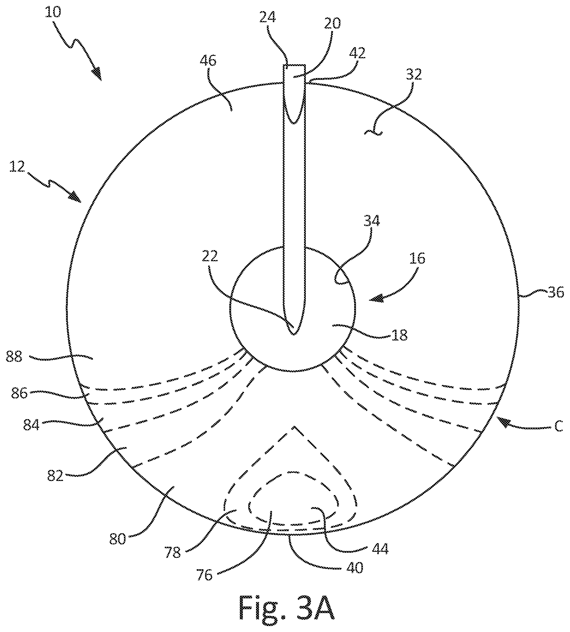 Patent US12360134 Figure 7 – Angle of attack sensor with sloped faceplate