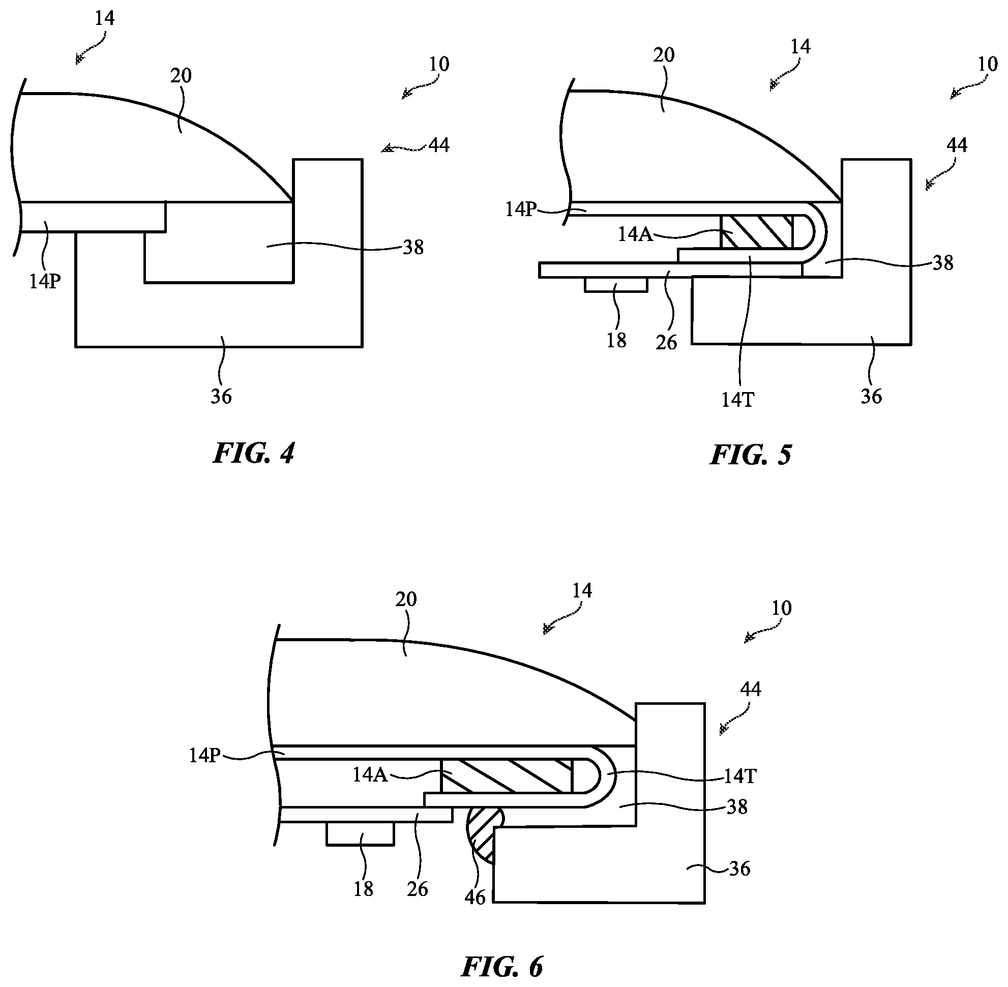 Patent US12360567 Figure 4 – Electronic devices with molded display mounting structures