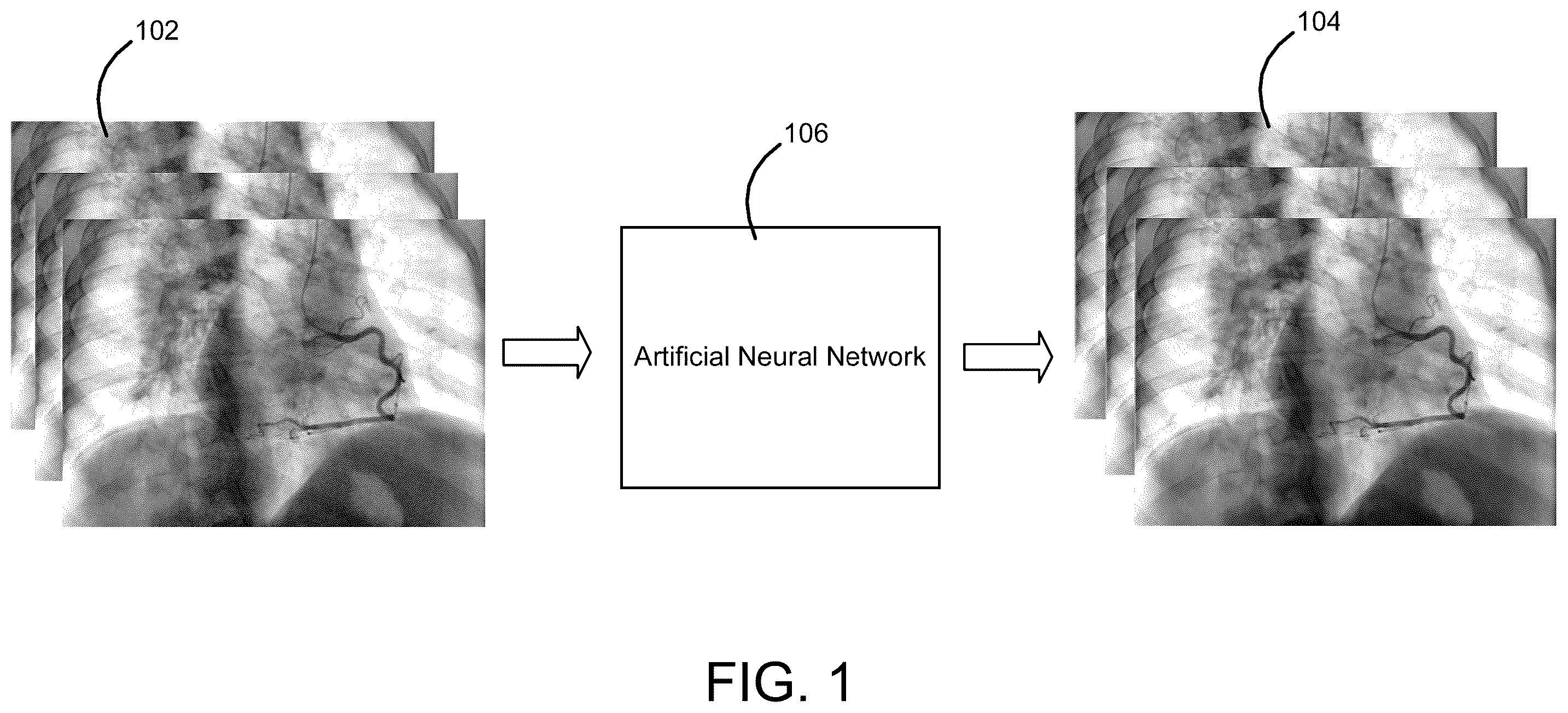 Patent US12361520 Figure 1 – Systems and methods for deblurring and denoising medical images