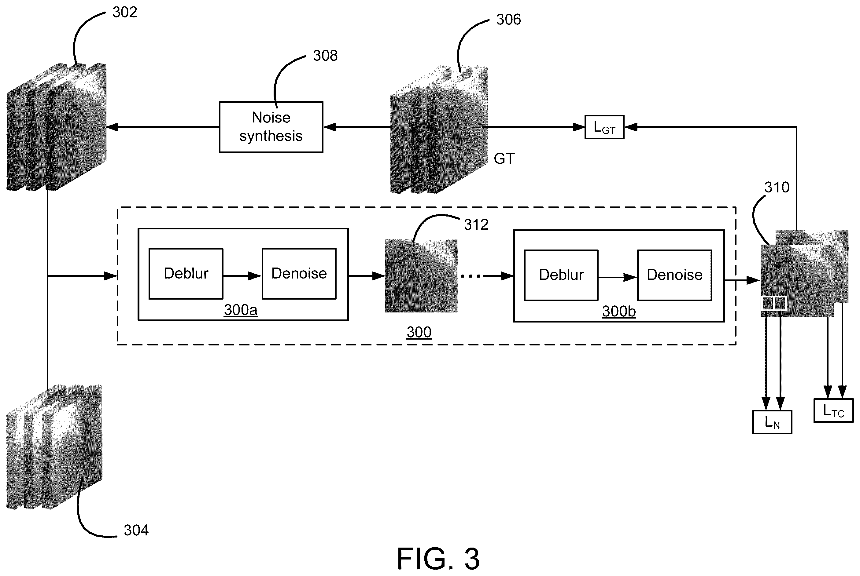 Patent US12361520 Figure 3 – Systems and methods for deblurring and denoising medical images