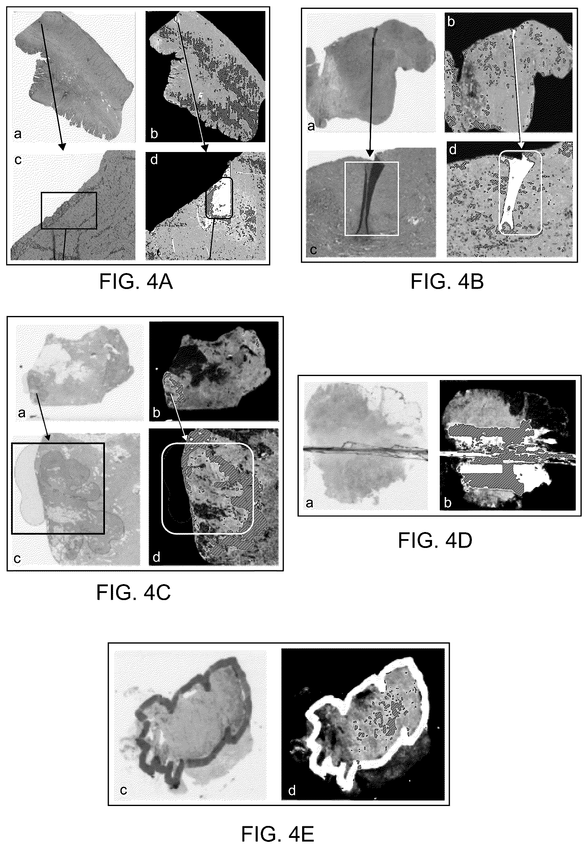 Patent US12361528 Figure 4 – Image quality analysis for artifact detection in pathology slide images