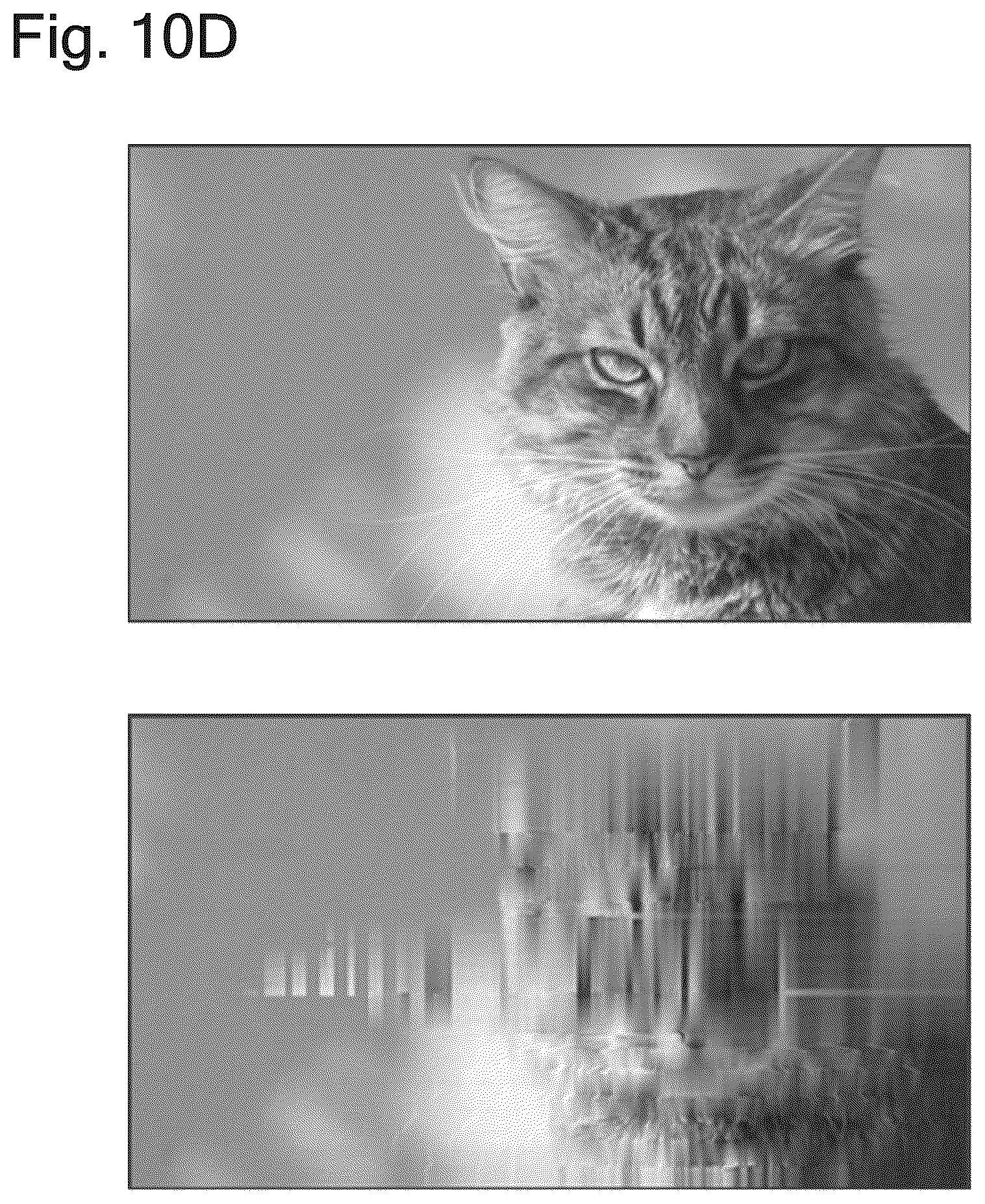Patent US12361529 Figure 13 – Training data generation method, method and device for generating learned model, recording medium, program, and information processing device