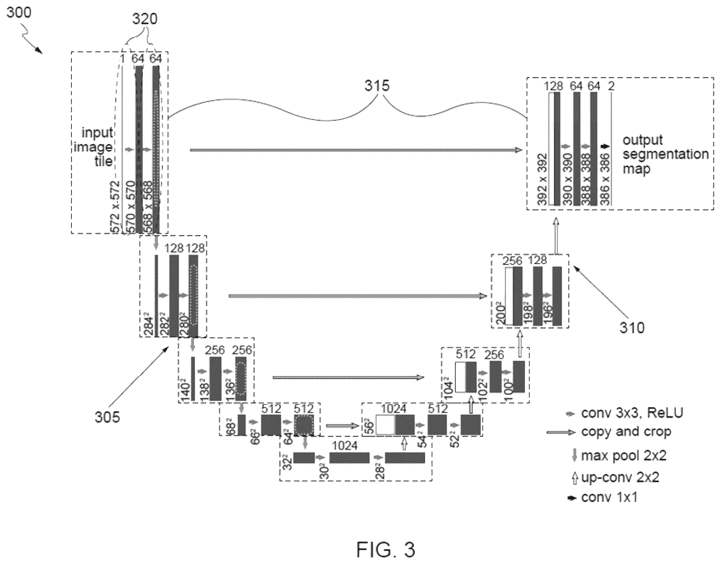 Patent US12361543 Figure 3 – Automated detection of tumors based on image processing