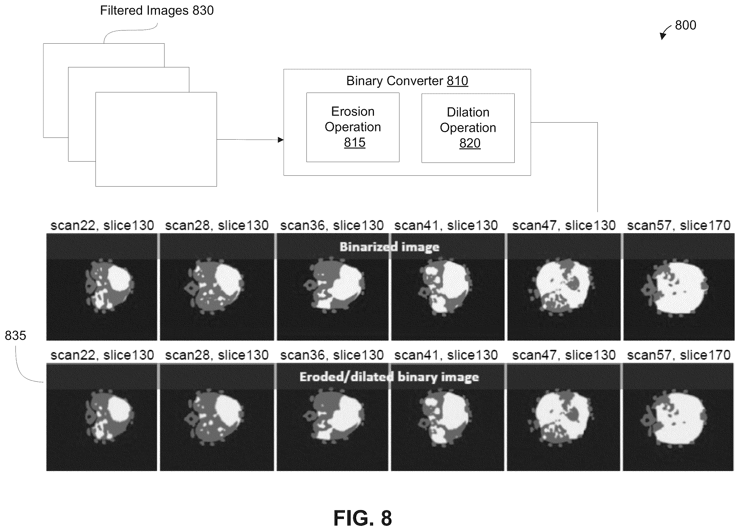 Patent US12361543 Figure 9 – Automated detection of tumors based on image processing
