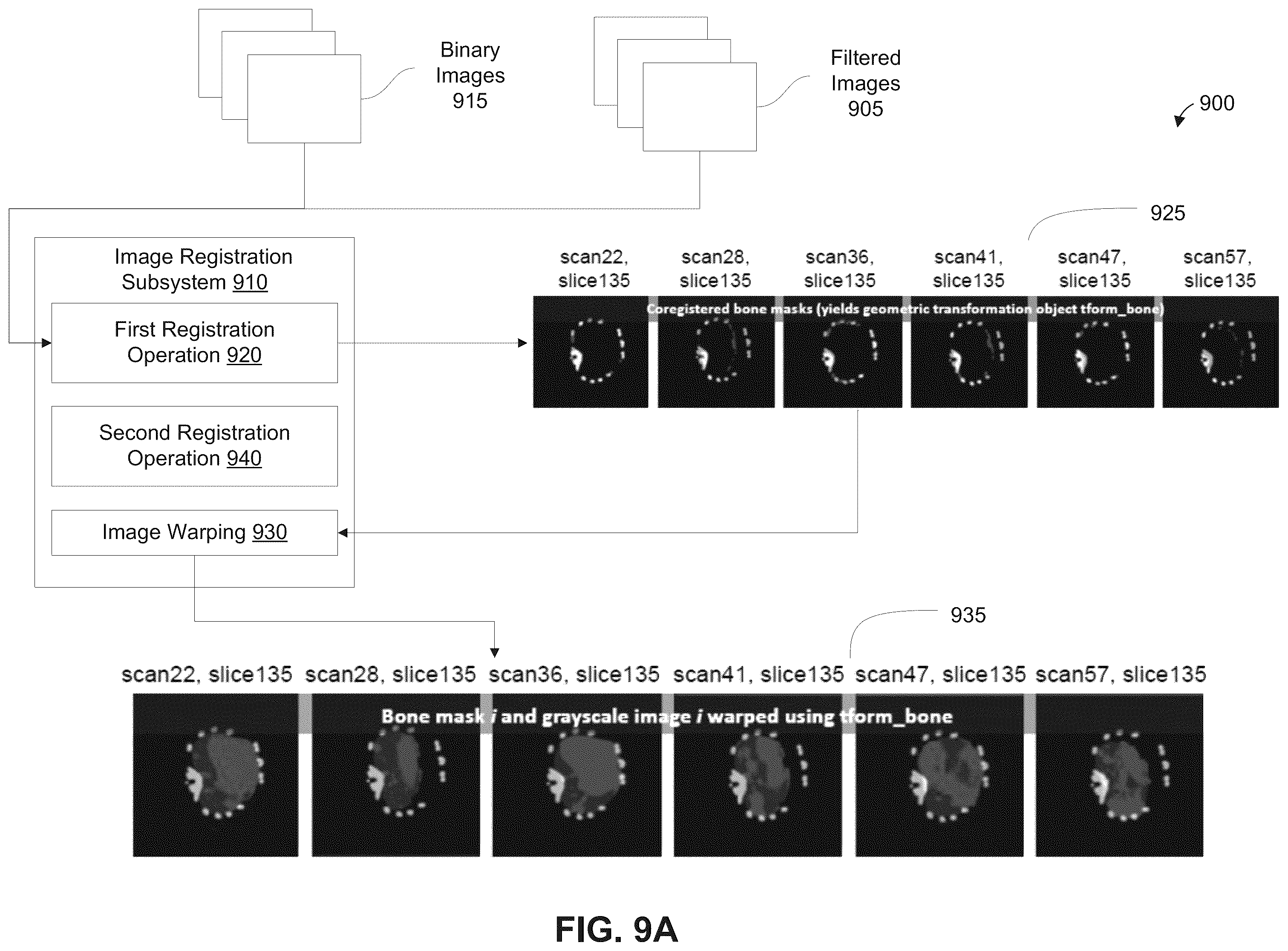 Patent US12361543 Figure 10 – Automated detection of tumors based on image processing