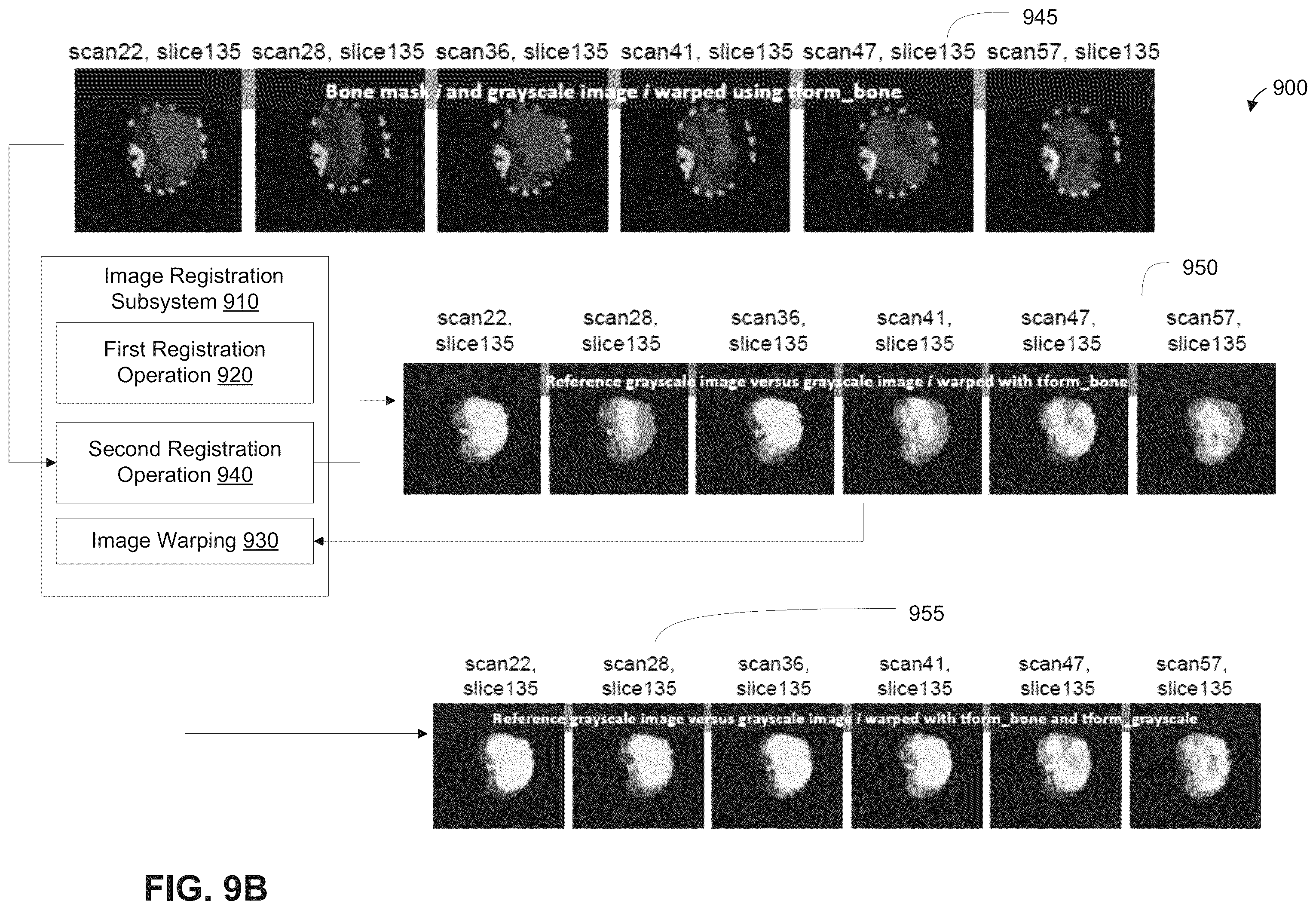 Patent US12361543 Figure 11 – Automated detection of tumors based on image processing