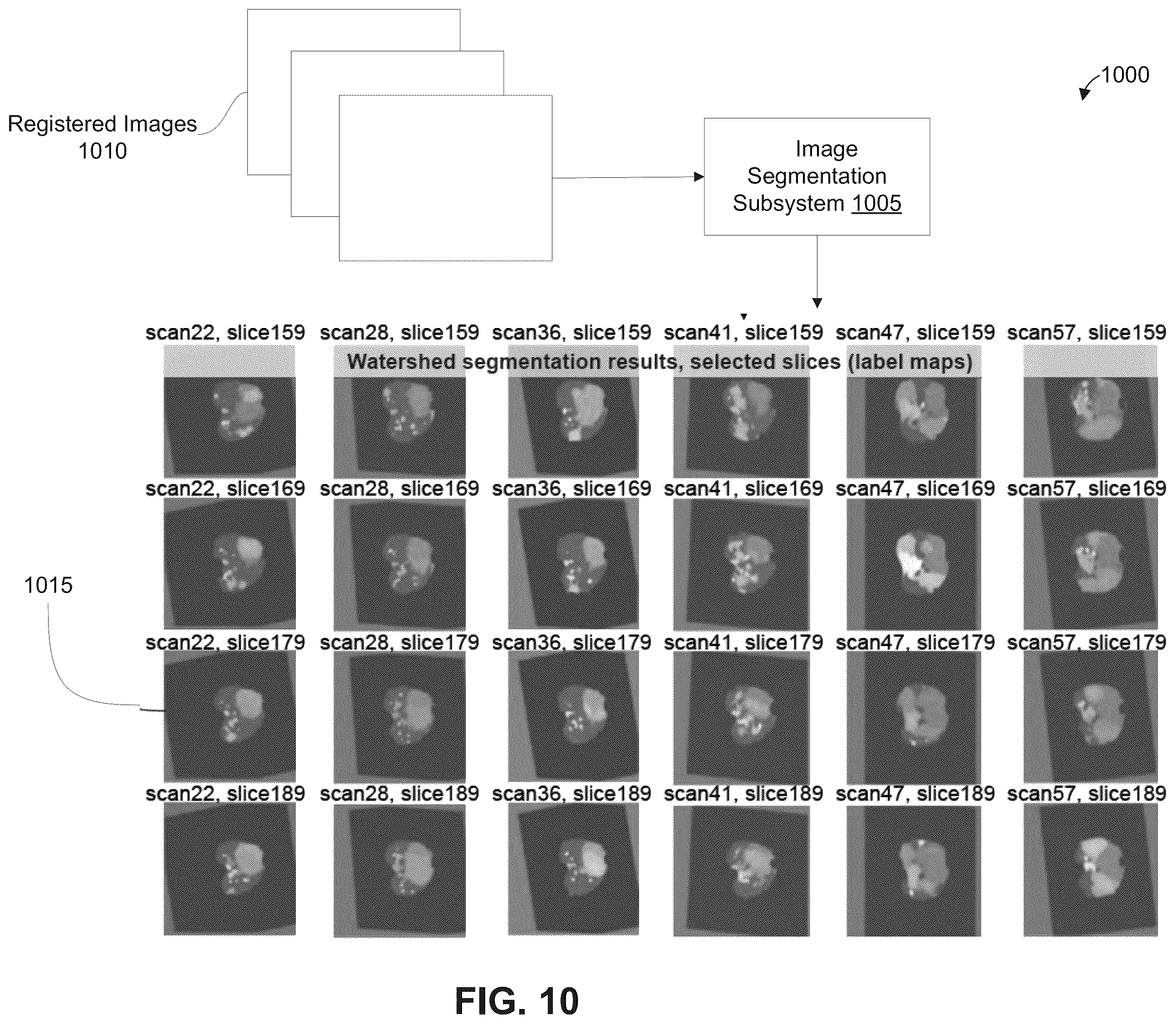 Patent US12361543 Figure 12 – Automated detection of tumors based on image processing