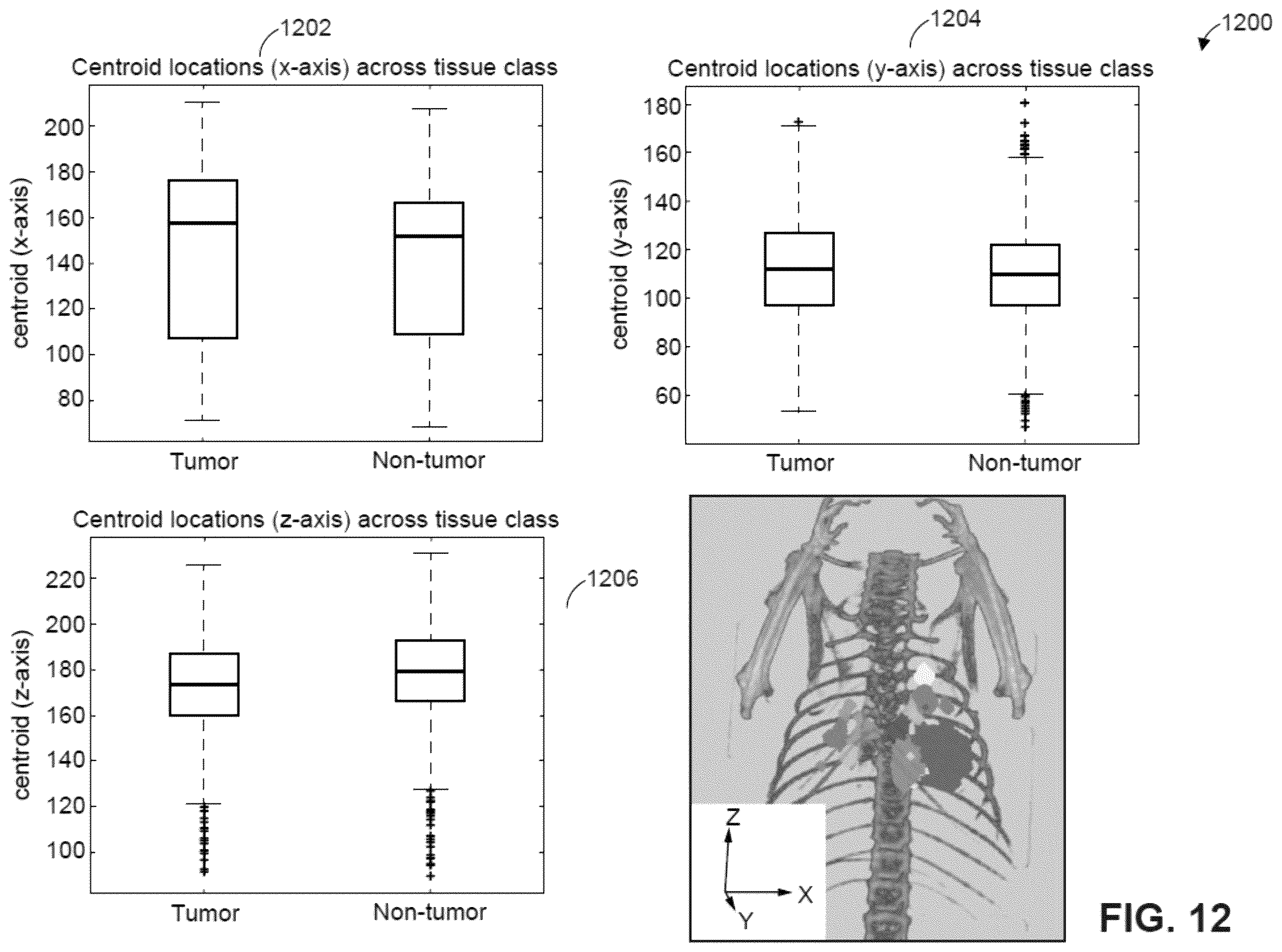 Patent US12361543 Figure 14 – Automated detection of tumors based on image processing