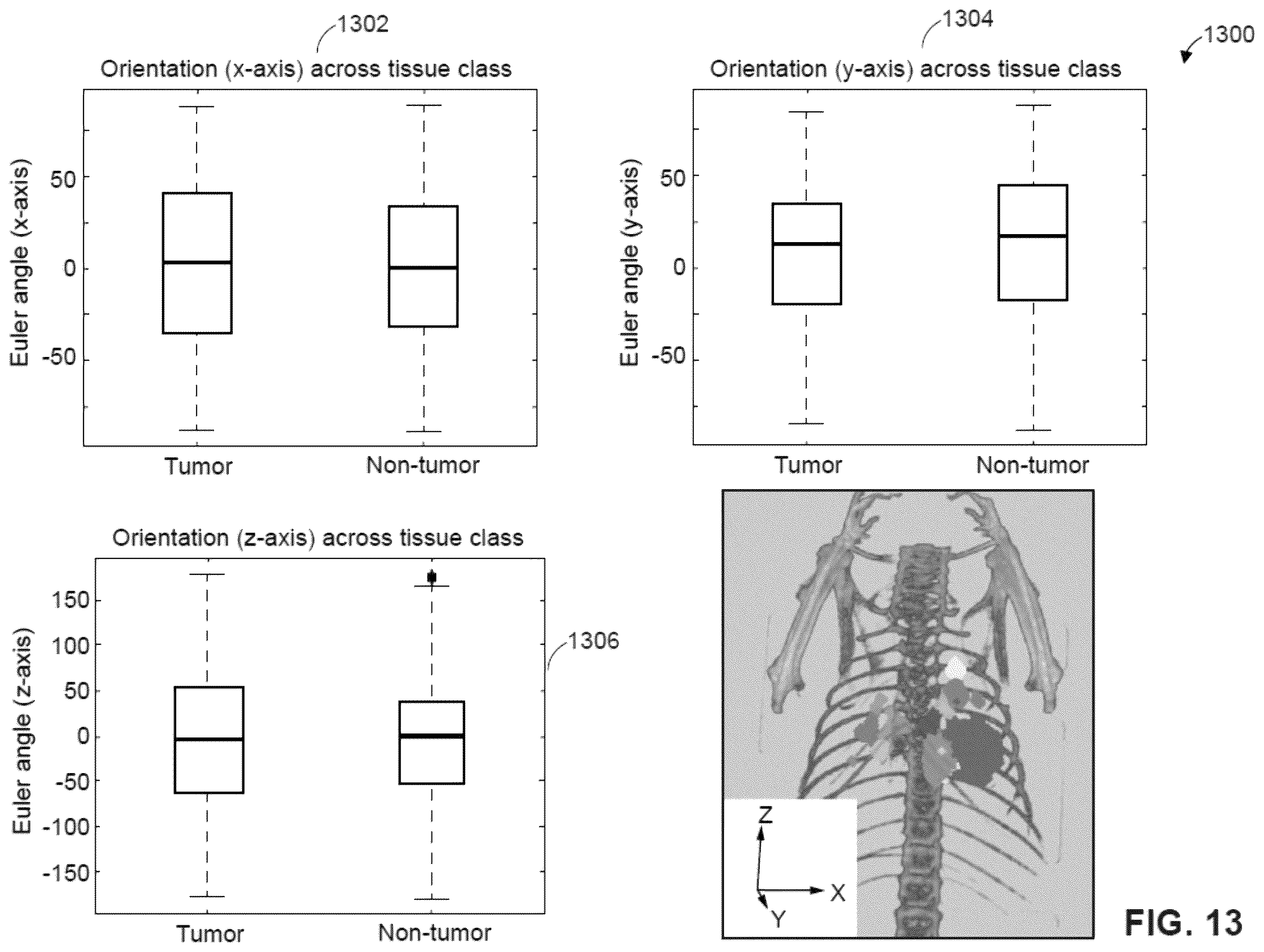 Patent US12361543 Figure 15 – Automated detection of tumors based on image processing