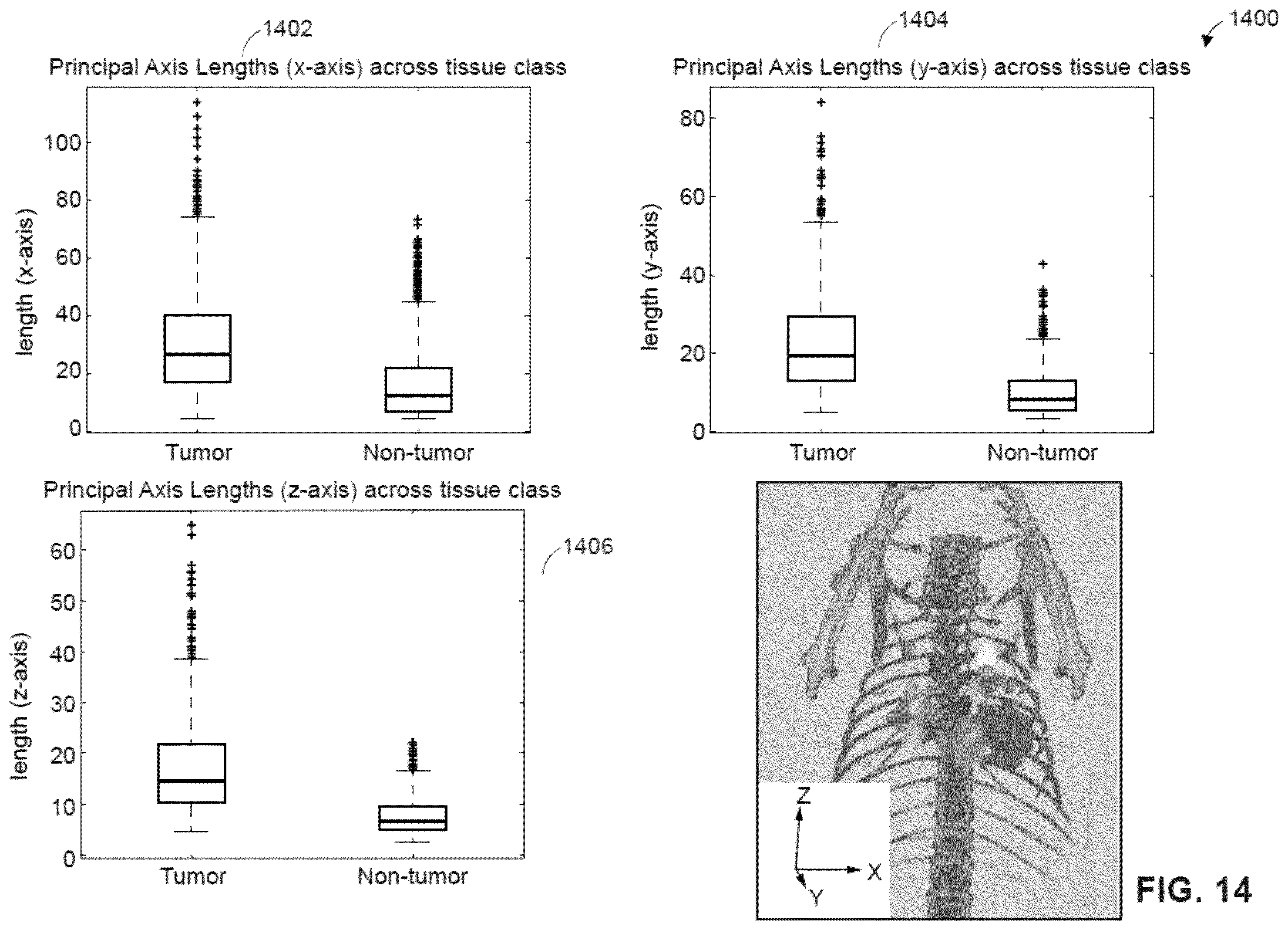 Patent US12361543 Figure 16 – Automated detection of tumors based on image processing