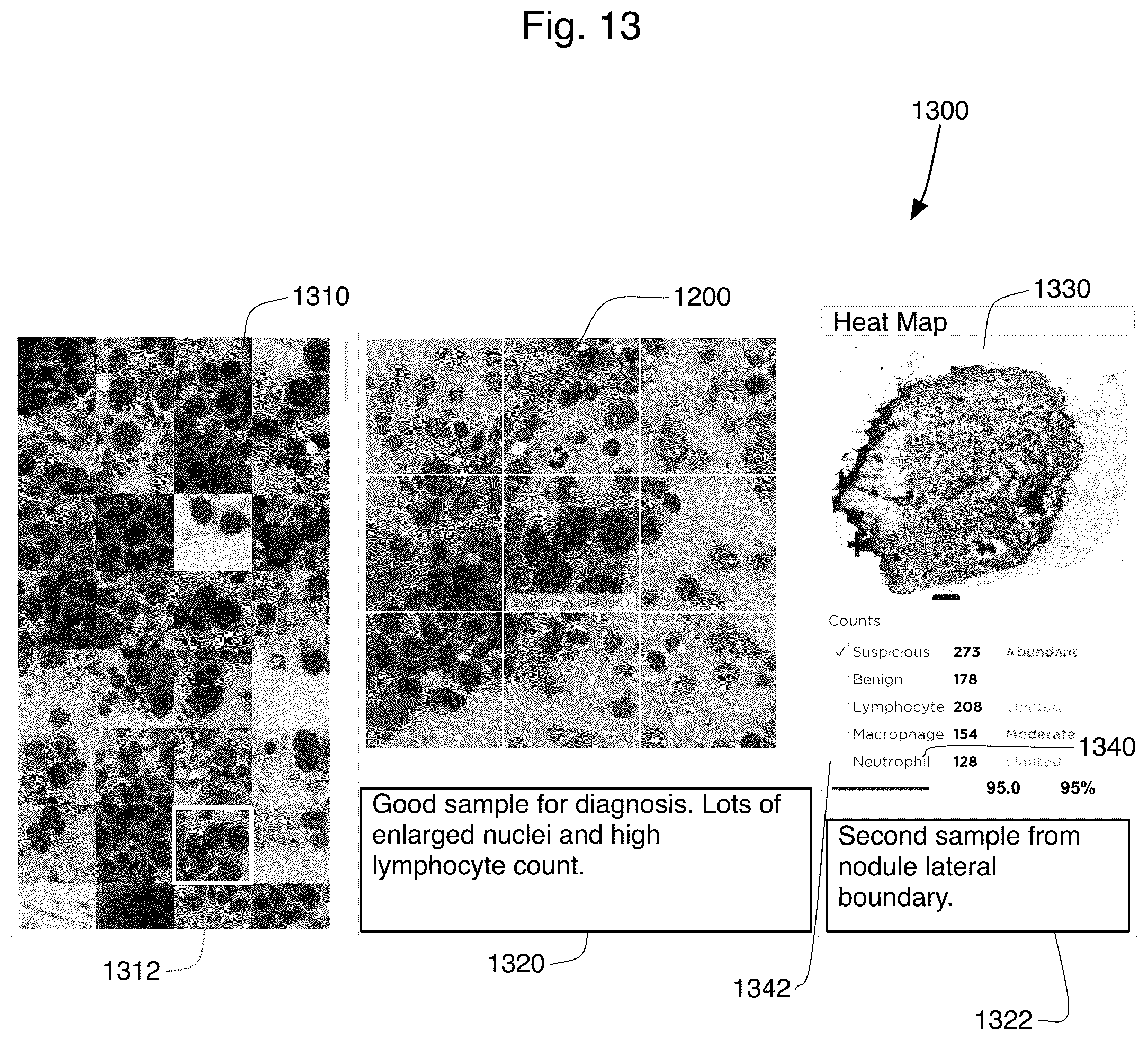 Patent US12361545 Figure 13 – Rapid on-site evaluation using artificial intelligence for lung cytopathology