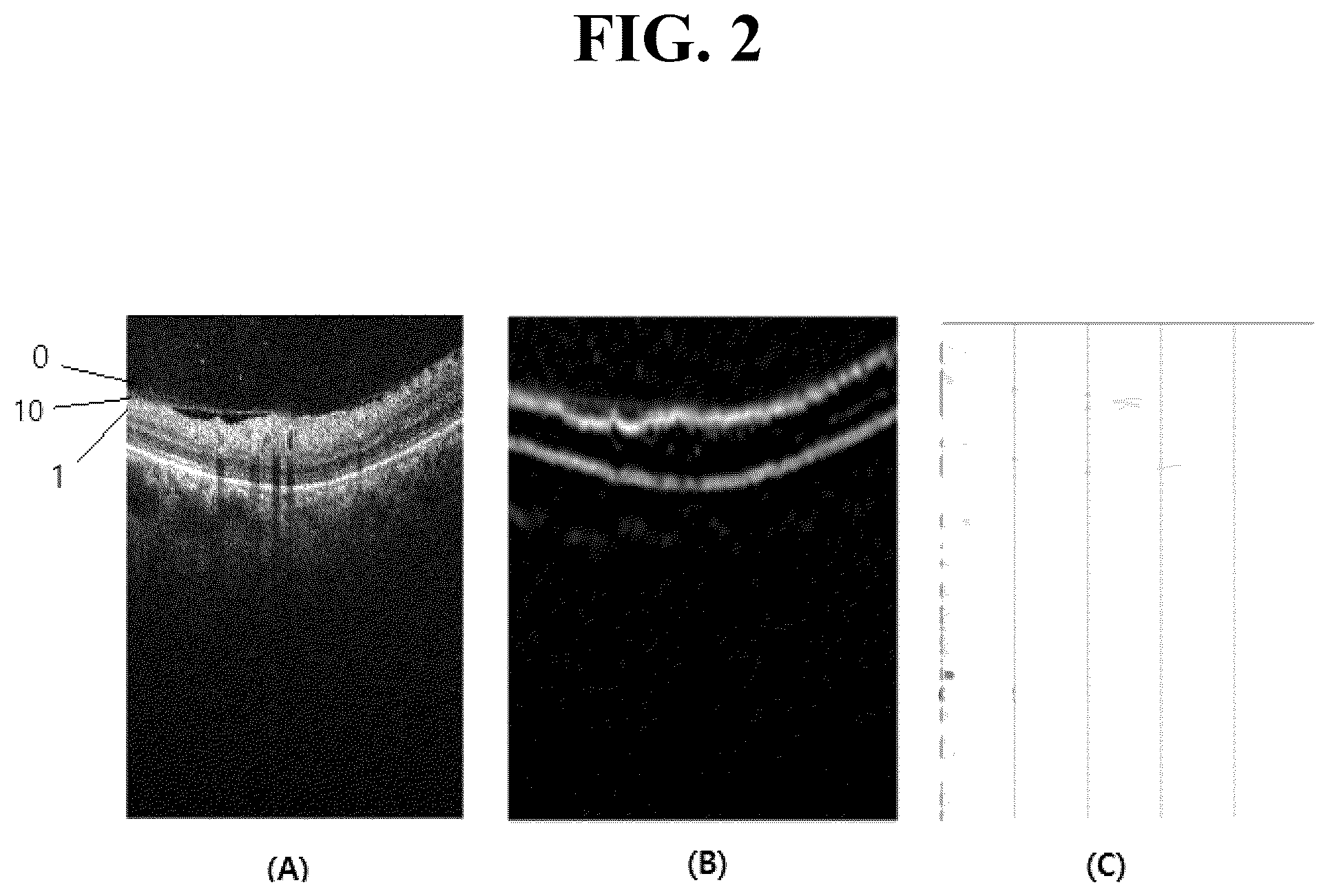 Patent US12361546 Figure 2 – Method for measuring retinal layer in OCT image