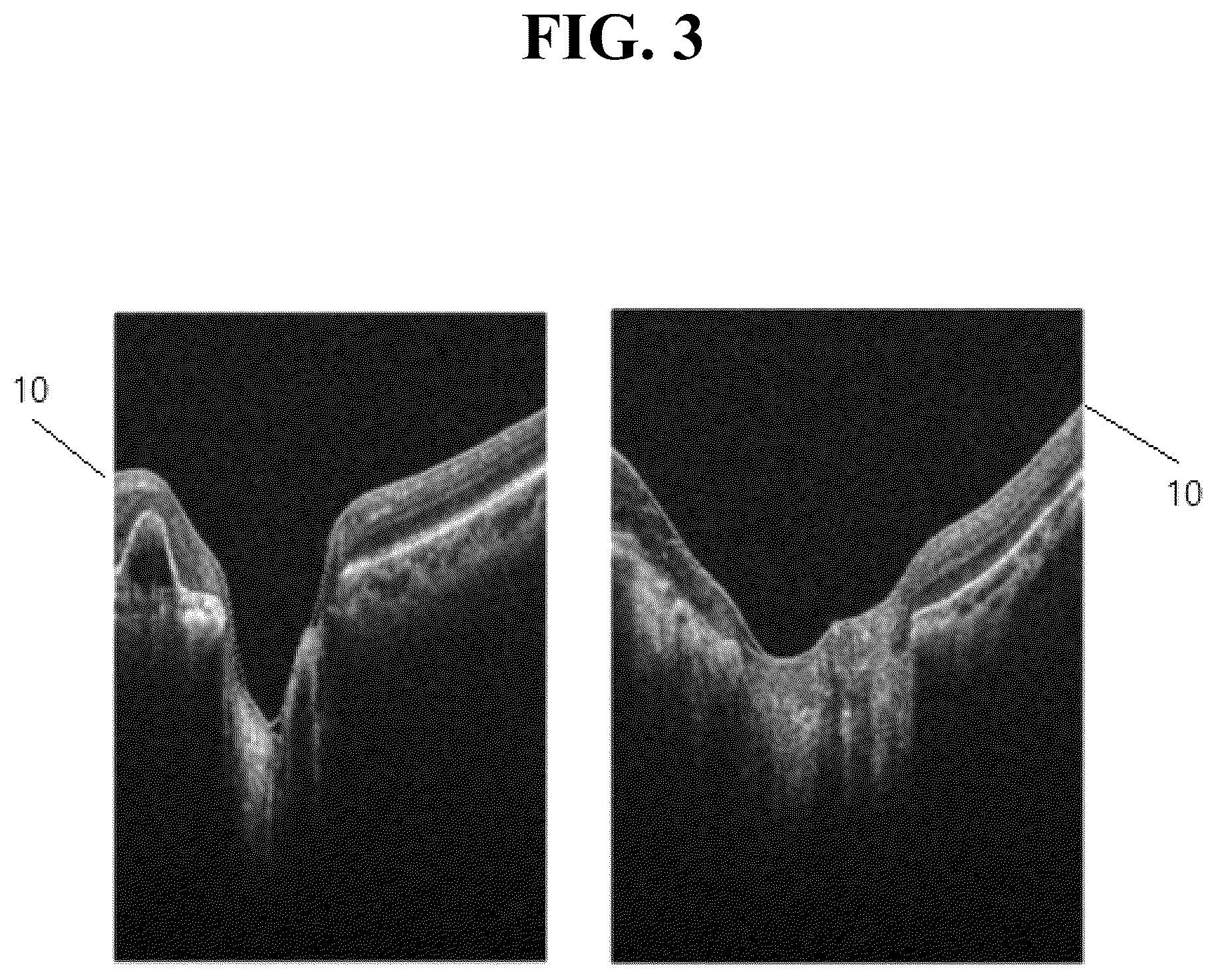 Patent US12361546 Figure 3 – Method for measuring retinal layer in OCT image