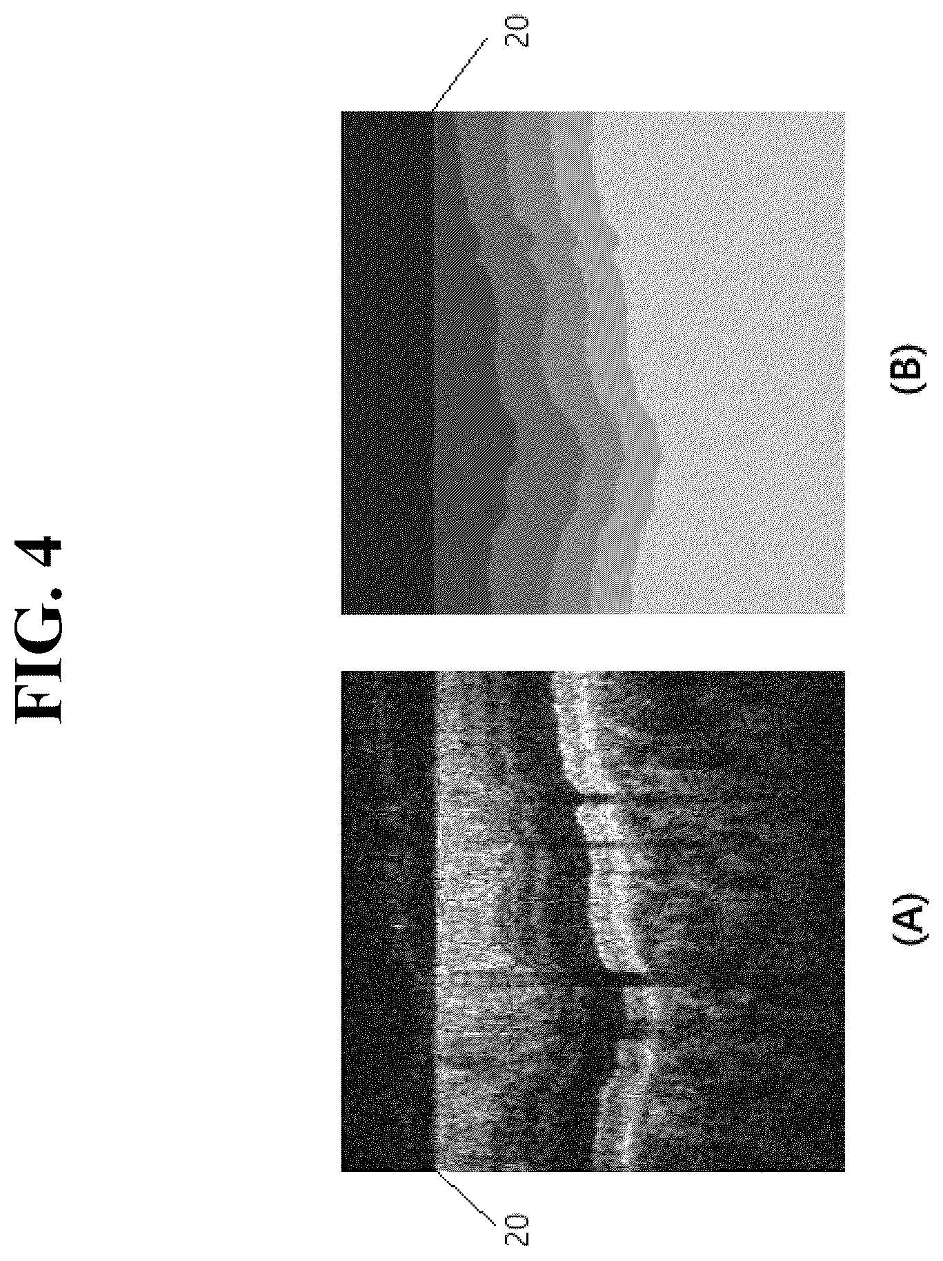 Patent US12361546 Figure 4 – Method for measuring retinal layer in OCT image