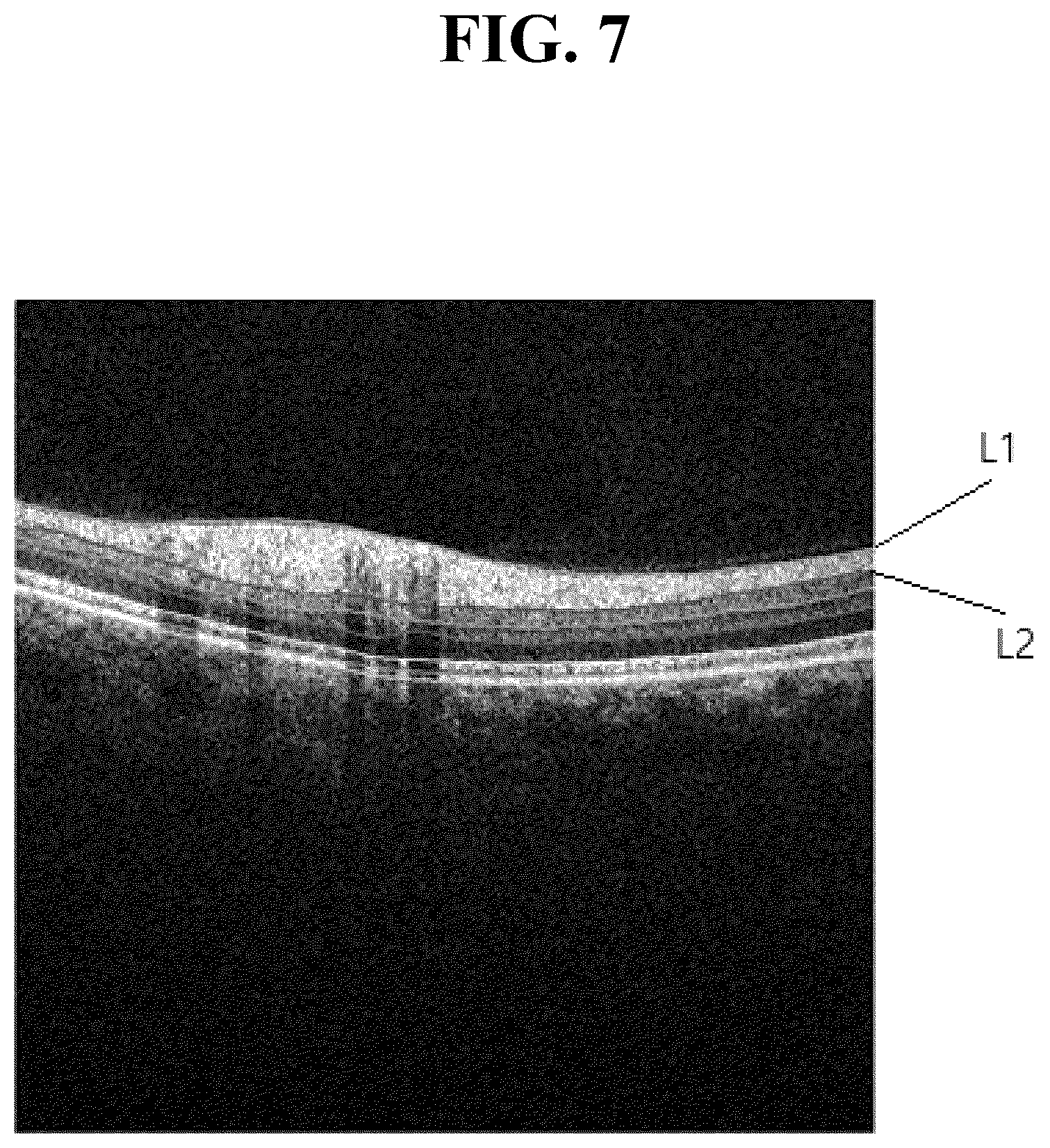 Patent US12361546 Figure 8 – Method for measuring retinal layer in OCT image