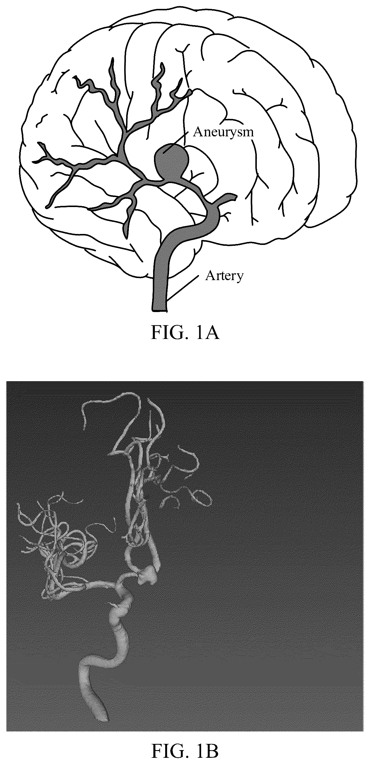 Patent US12361547 Figure 1 – Data processing method and apparatus, device and medium