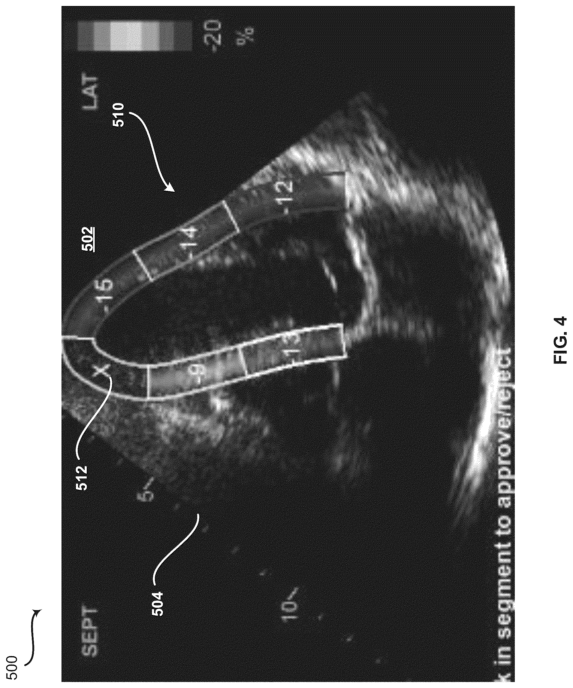 Patent US12361548 Figure 4 – Method and system for providing an objective image quality metric after ultrasound image acquisition and prior to permanent storage