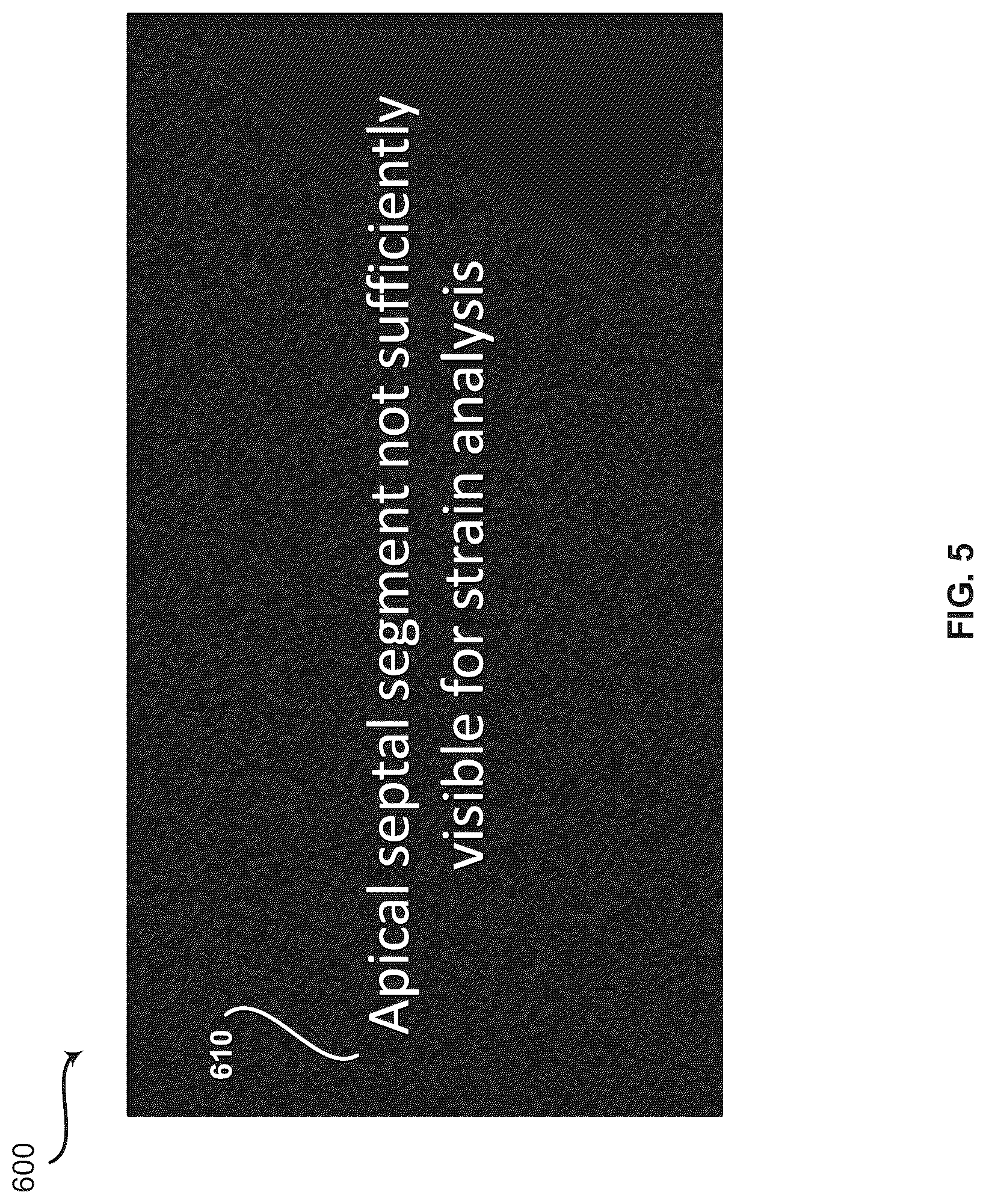 Patent US12361548 Figure 5 – Method and system for providing an objective image quality metric after ultrasound image acquisition and prior to permanent storage