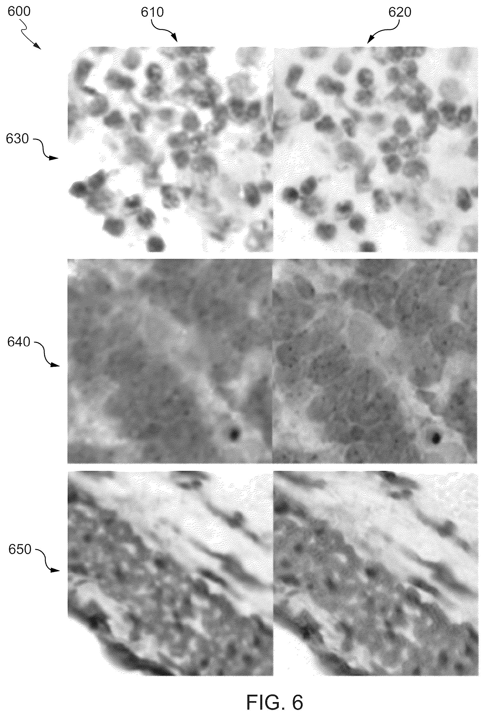 Patent US12361550 Figure 6 – Correcting differences in multi-scanners for digital pathology images using deep learning