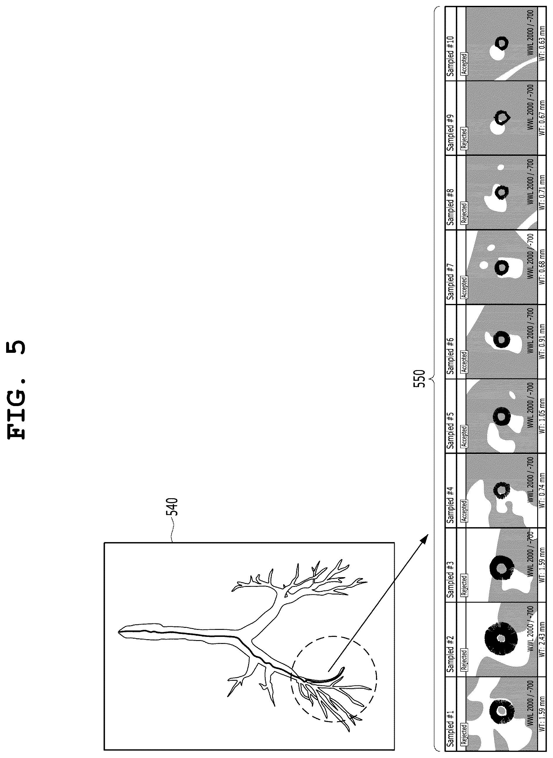 Patent US12361551 Figure 5 – Artificial neural network-based image analysis apparatus and method for evaluating analysis results of artificial neural network