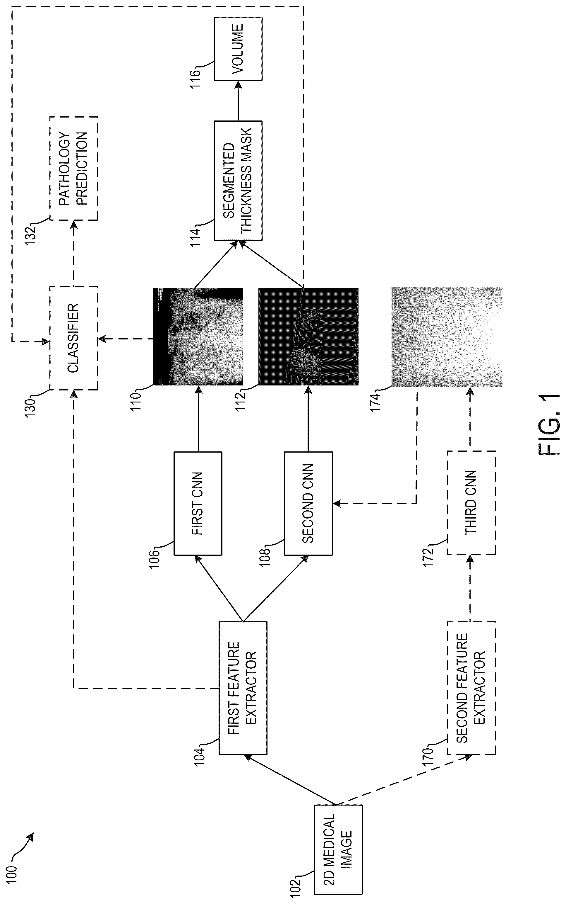 Patent US12361553 Figure 1 – System and methods for inferring thickness of object classes of interest in two-dimensional medical images using deep neural networks