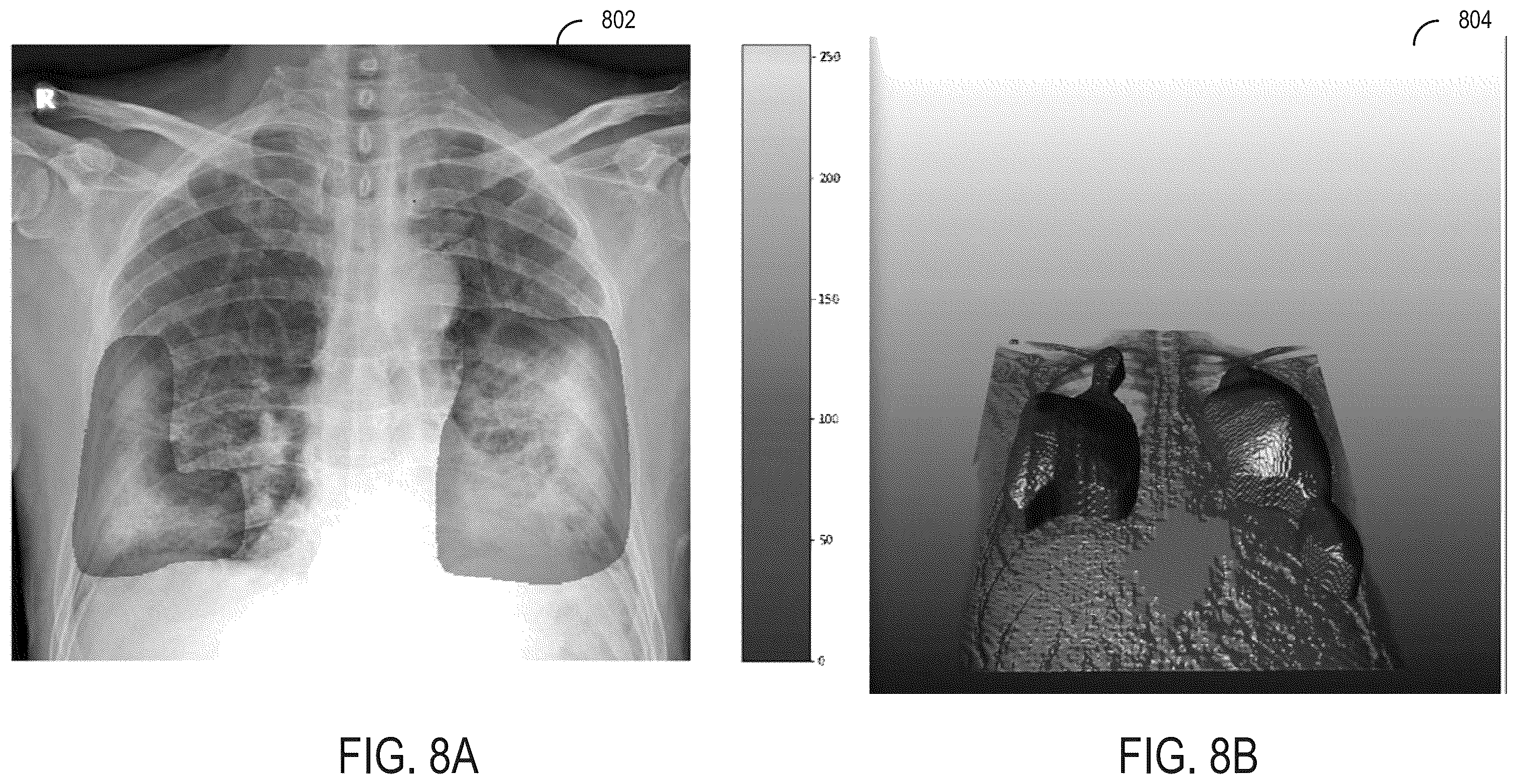 Patent US12361553 Figure 8 – System and methods for inferring thickness of object classes of interest in two-dimensional medical images using deep neural networks