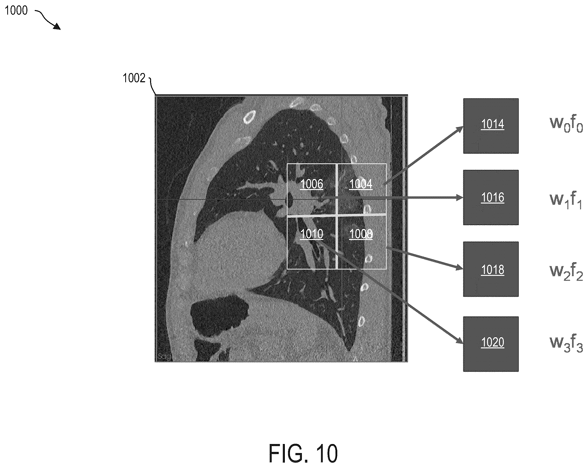 Patent US12361553 Figure 10 – System and methods for inferring thickness of object classes of interest in two-dimensional medical images using deep neural networks