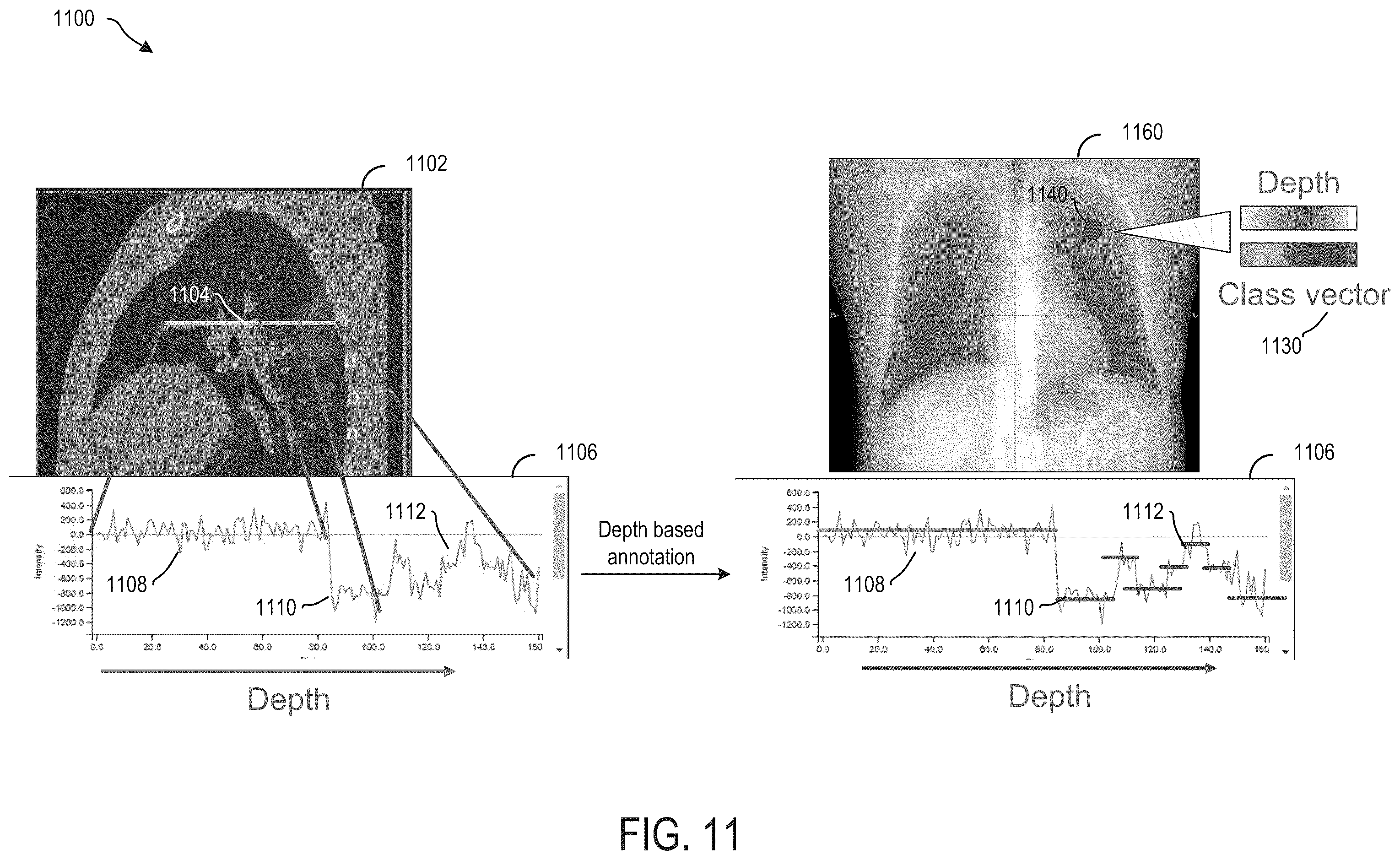Patent US12361553 Figure 11 – System and methods for inferring thickness of object classes of interest in two-dimensional medical images using deep neural networks
