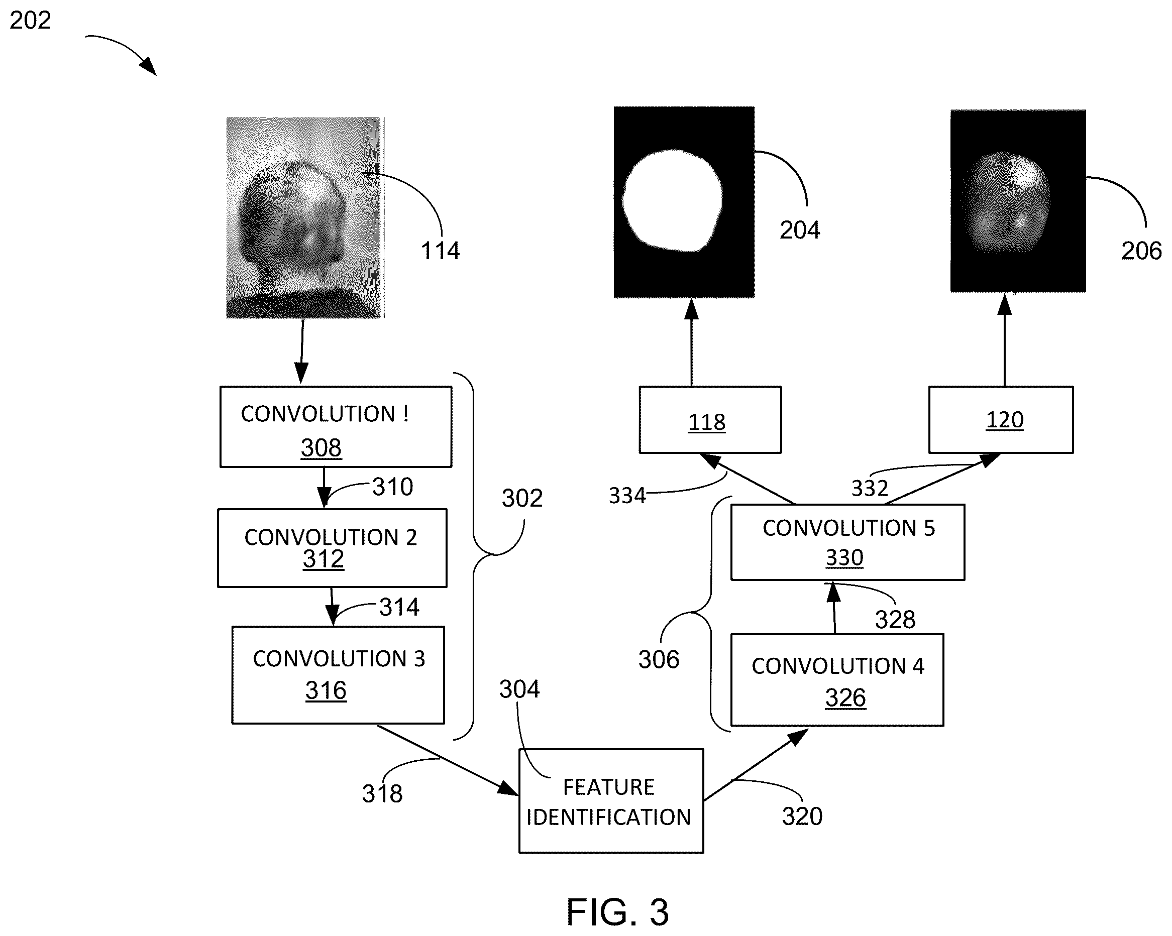 Patent US12361556 Figure 3 – Compute system with head ailment diagnostic mechanism and method of operation thereof