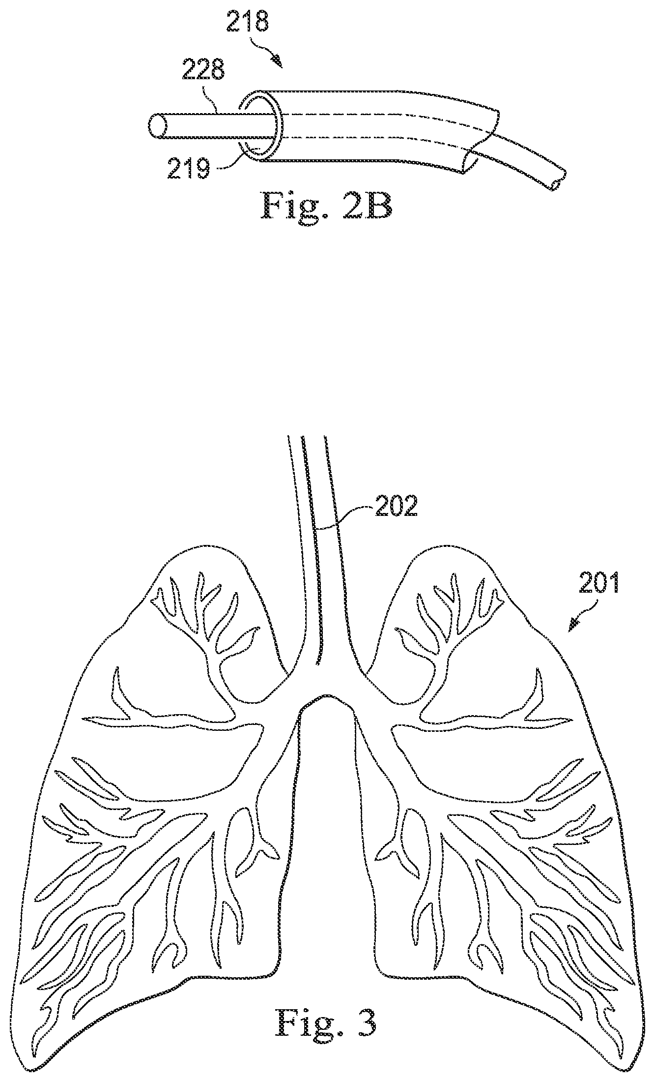 Patent US12361558 Figure 3 – Systems and methods of registration for image-guided surgery