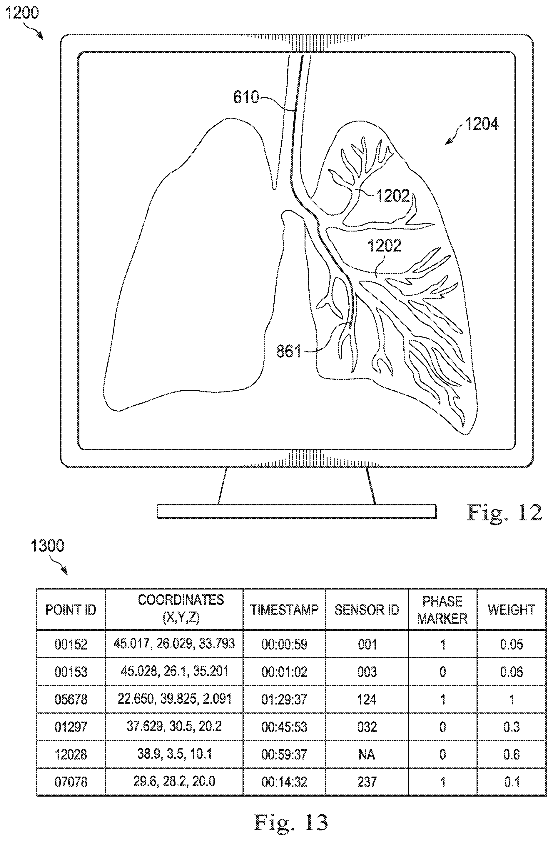 Patent US12361558 Figure 16 – Systems and methods of registration for image-guided surgery