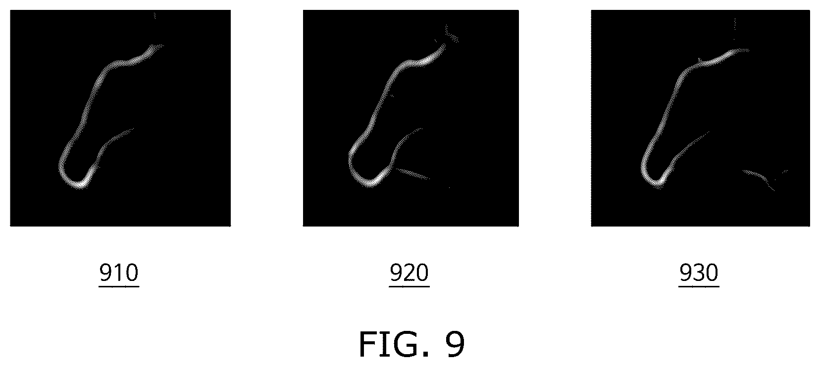 Patent US12361559 Figure 9 – Method and system for computing blood flow velocity based on medical image