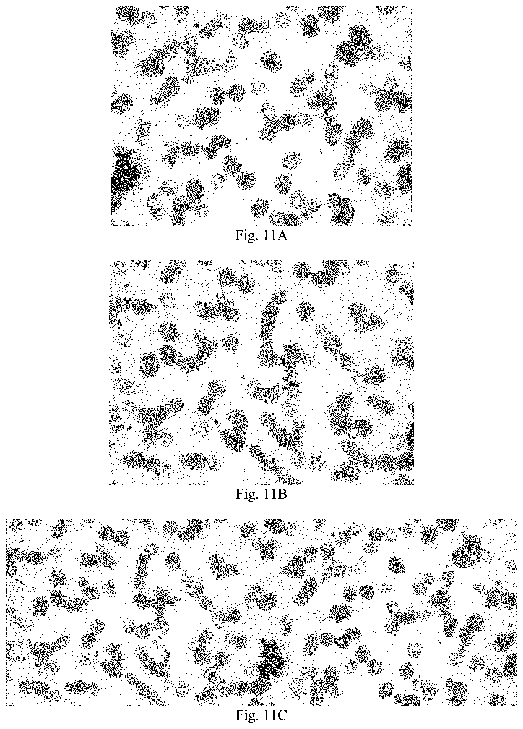 Patent US12361560 Figure 7 – Blood smear full-view intelligent analysis method, and blood cell segmentation model and recognition model construction method