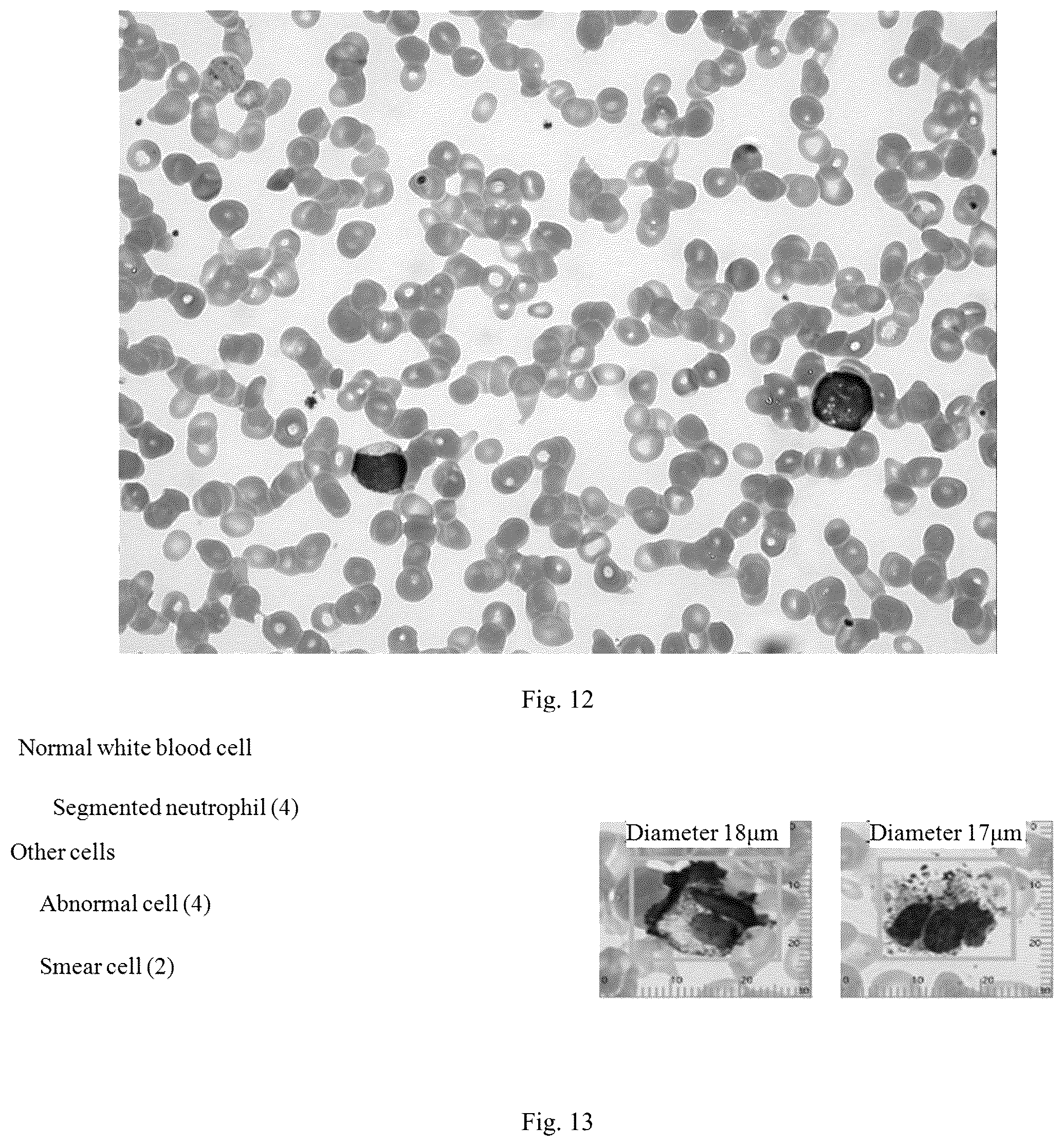Patent US12361560 Figure 8 – Blood smear full-view intelligent analysis method, and blood cell segmentation model and recognition model construction method