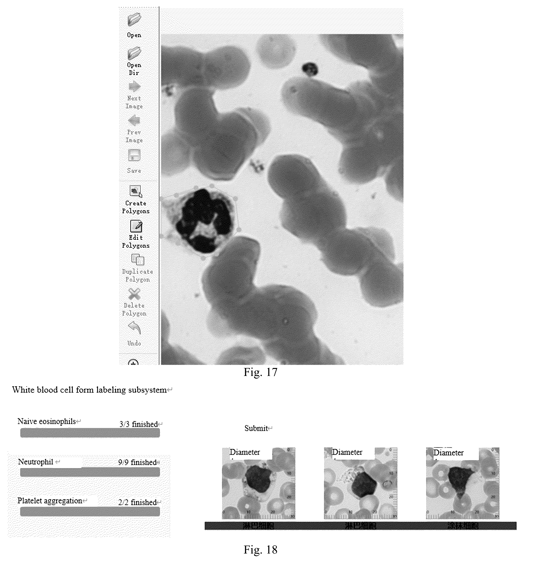 Patent US12361560 Figure 12 – Blood smear full-view intelligent analysis method, and blood cell segmentation model and recognition model construction method