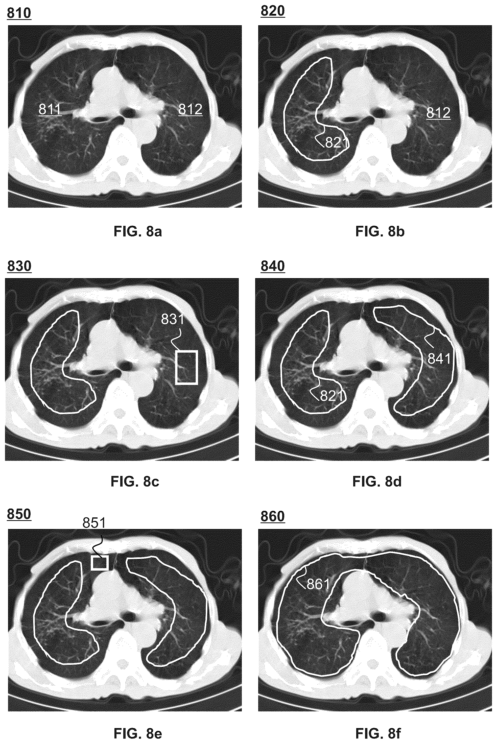 Patent US12361561 Figure 9 – Methods and systems for medical image segmentation