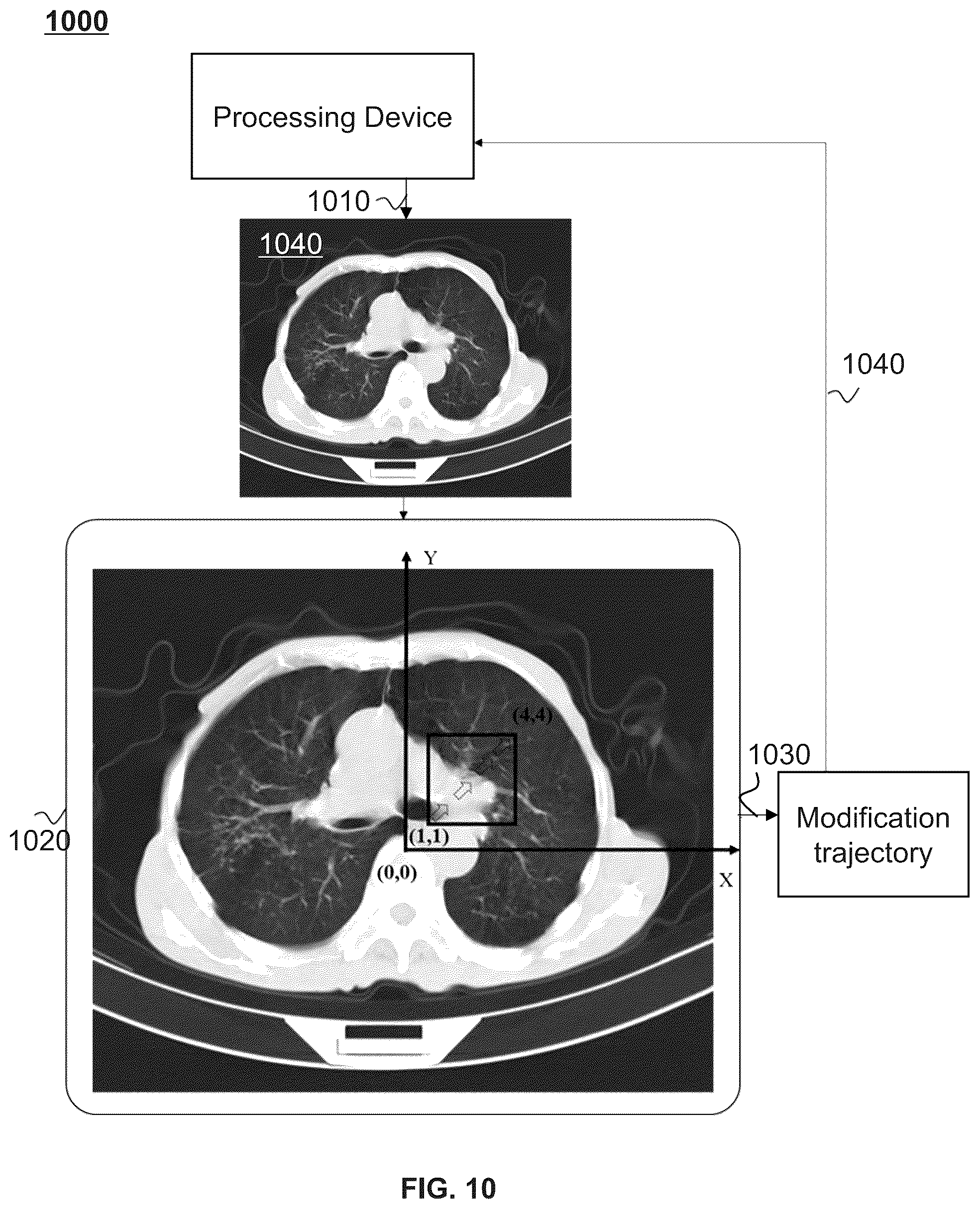 Patent US12361561 Figure 13 – Methods and systems for medical image segmentation