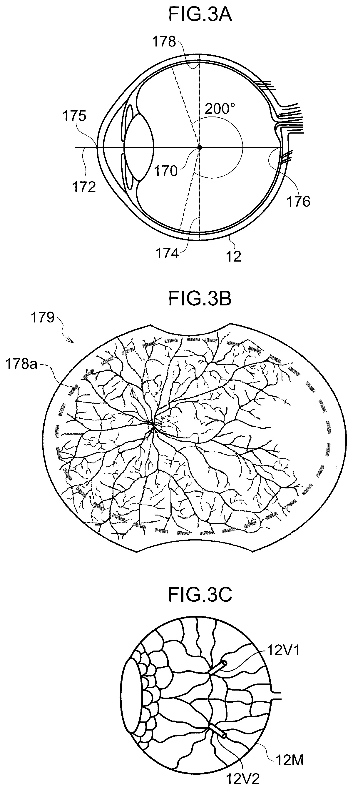 Patent US12361590 Figure 3 – Image processing method, image processing device, and program